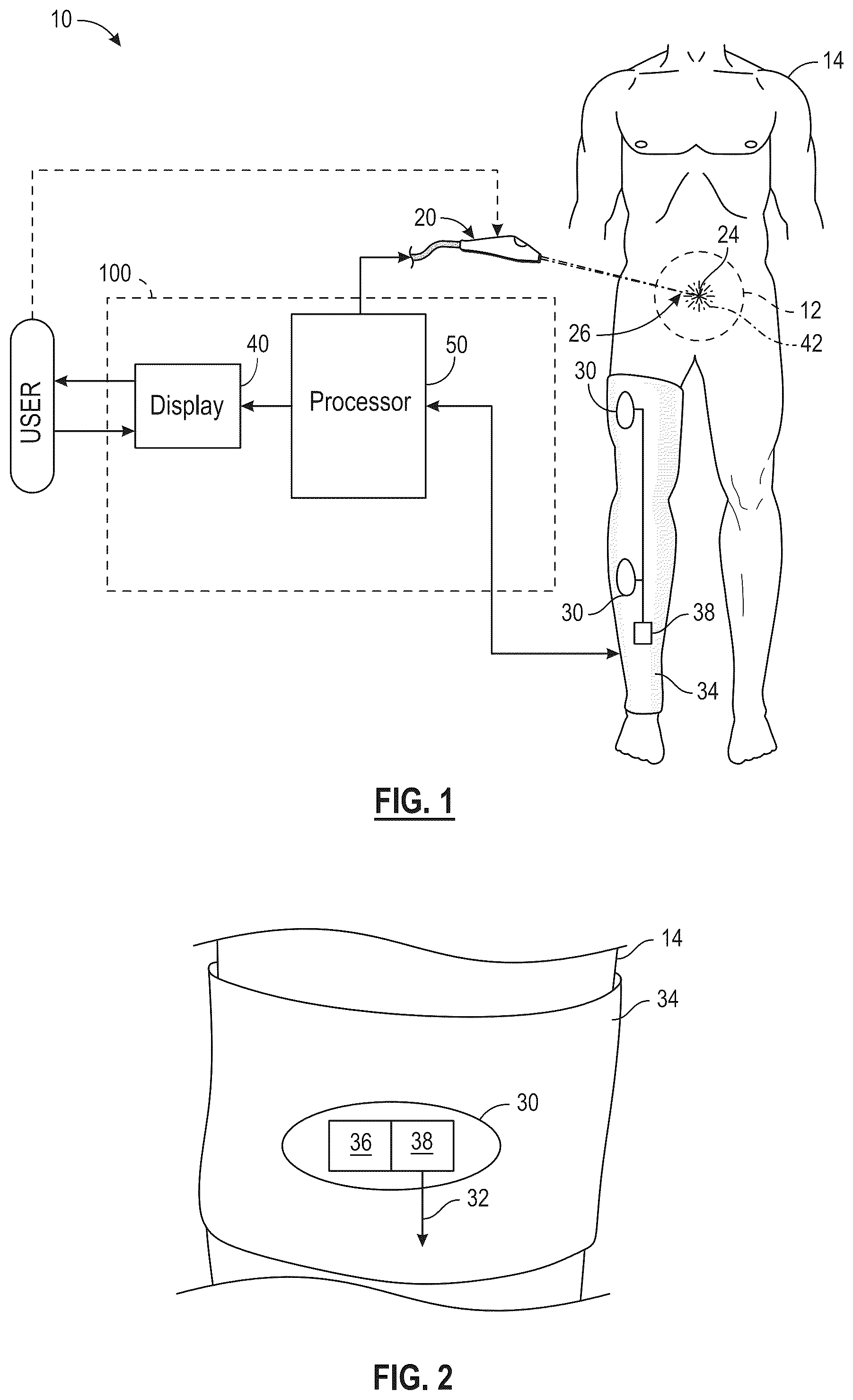 Patent US12588860 — System and method for intraoperative guidance — Figure 1