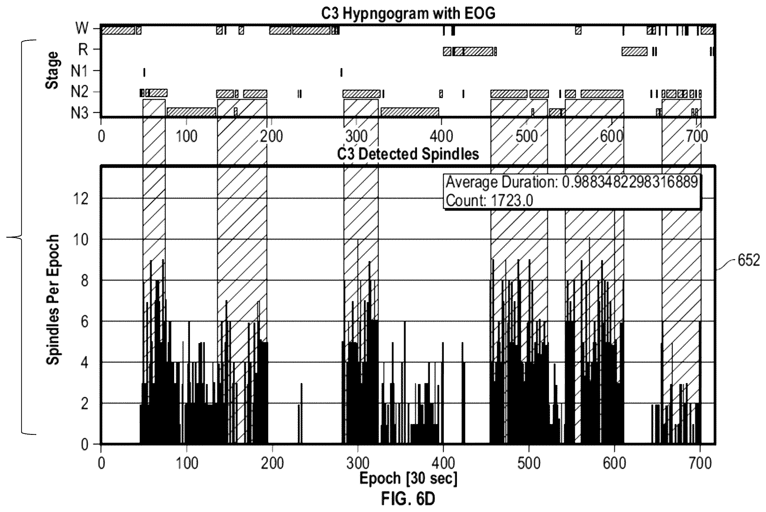 Patent US12588861 Figure 11 – Wearable device and method for non-invasive assessment of glymphatic flow