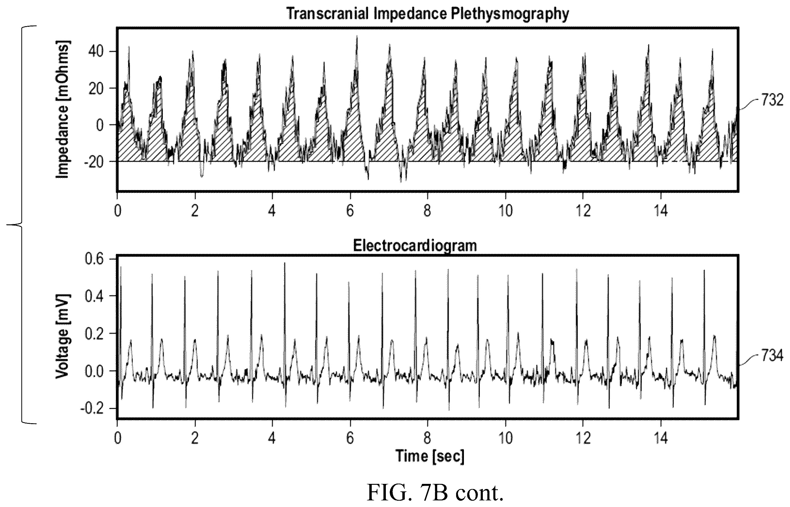 Patent US12588861 Figure 16 – Wearable device and method for non-invasive assessment of glymphatic flow