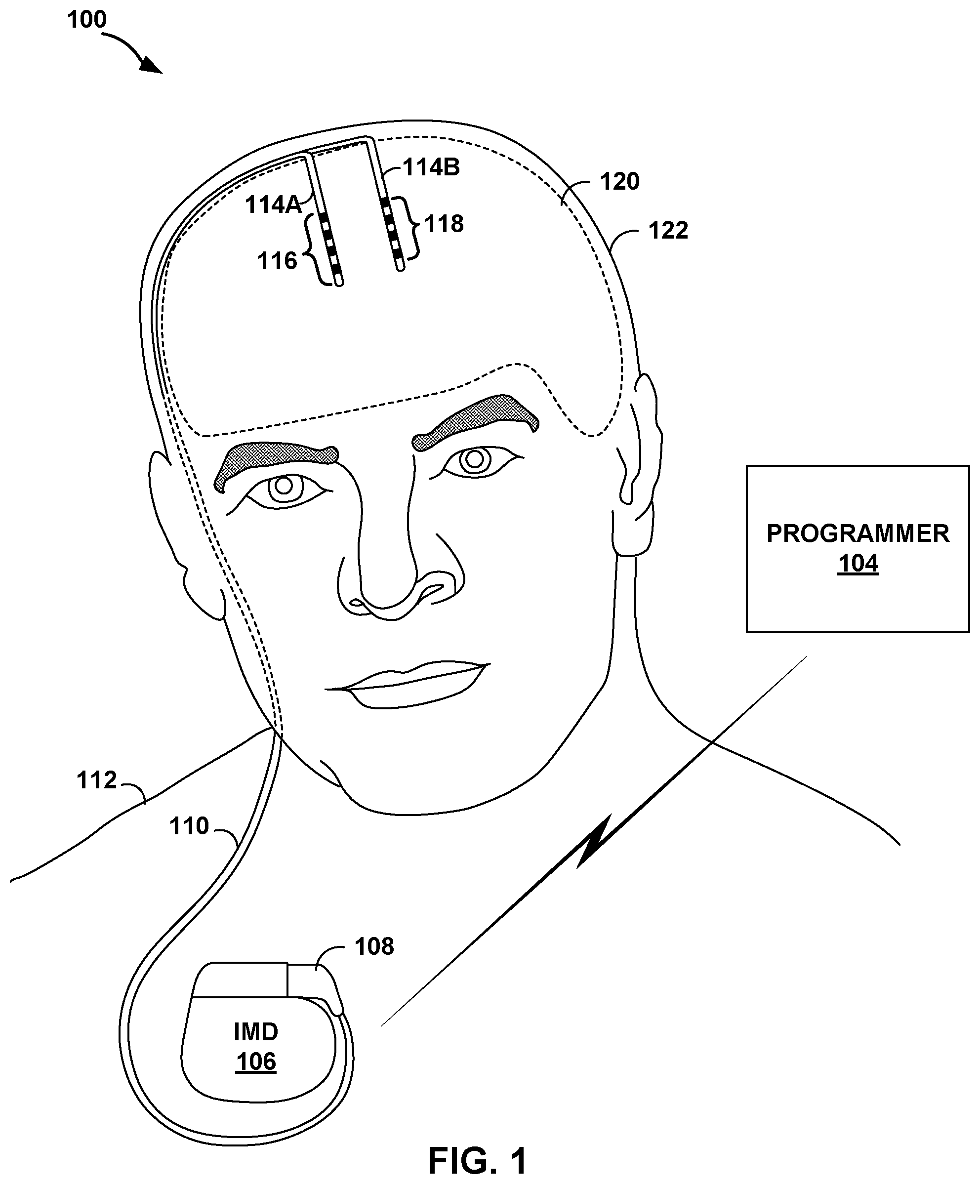 Patent US12588870 — Electrode orientation detection — Figure 1
