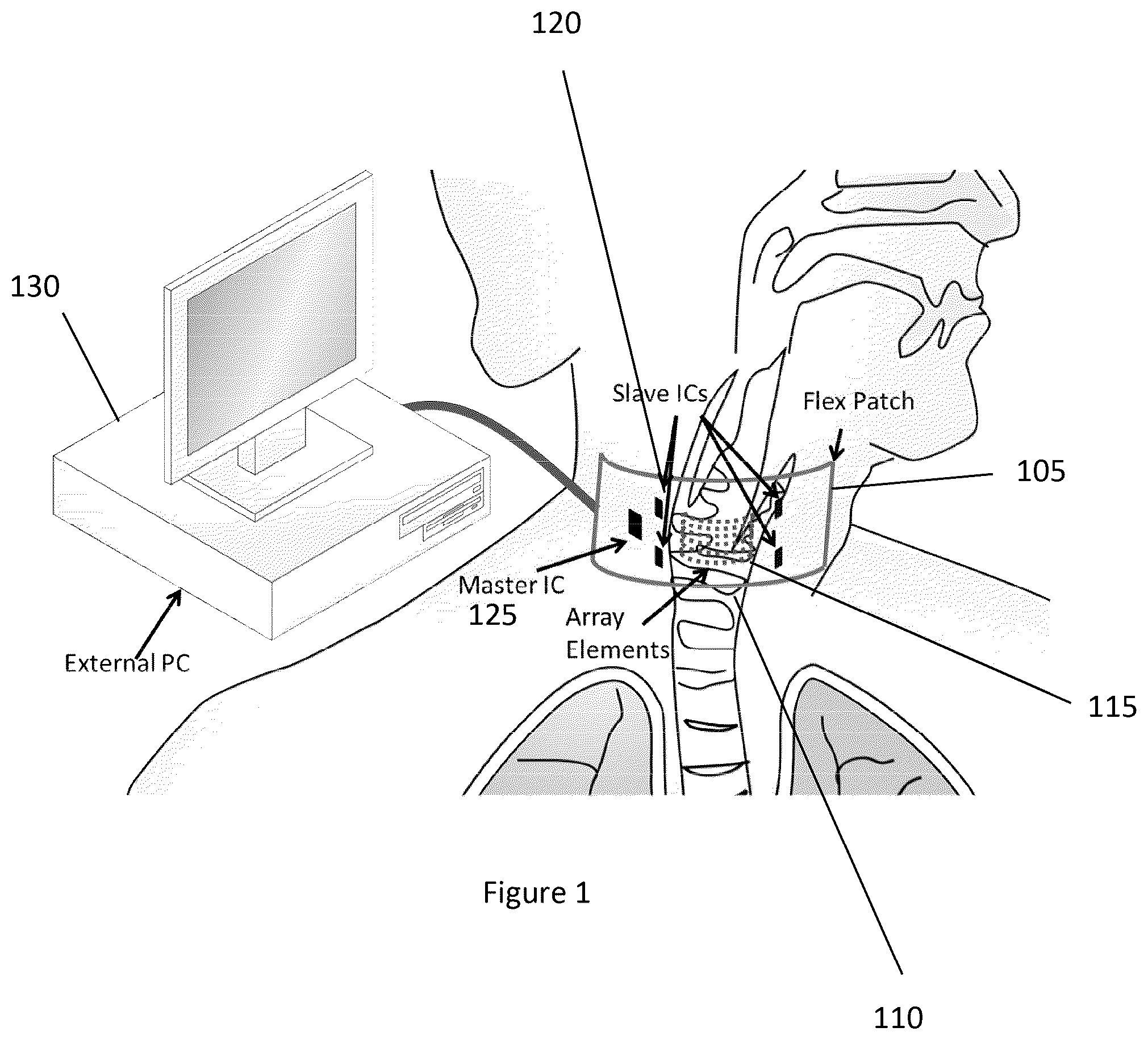 Patent US12588895 Figure 1 – System, method, computer-accessible medium and apparatus for flexible two-dimensional ultrasound phased array