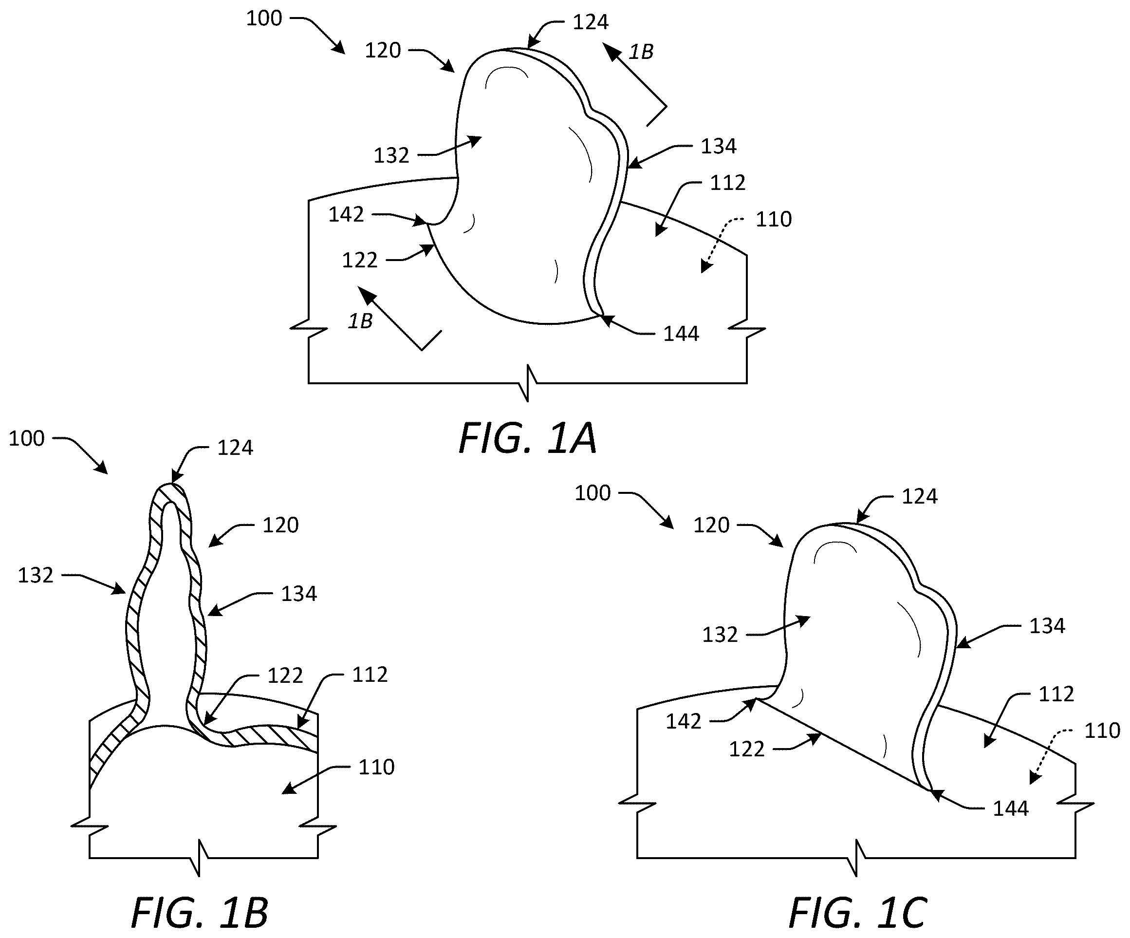 Patent US12588902 — Occlusion devices and methods having lateral pockets or sleeves — Figure 1