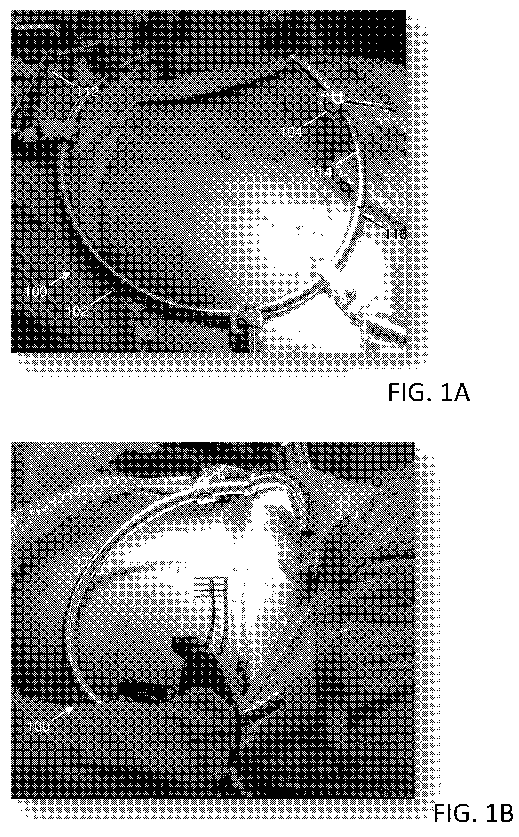 Patent US12588903 — Anterior to the psoas surgical access system and a modified surgical approach technique — Figure 1