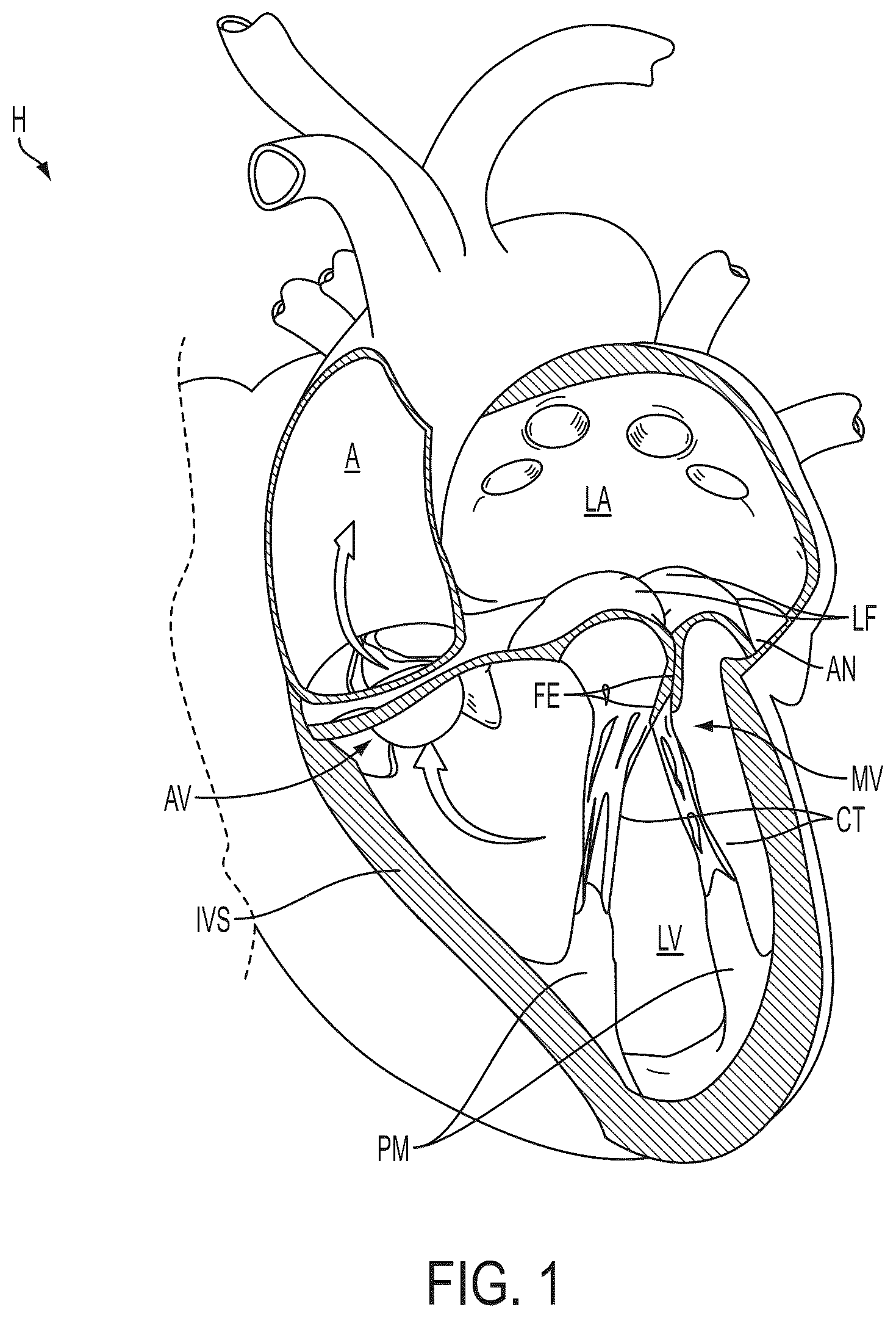 Patent US12588908 — Independent gripper — Figure 1