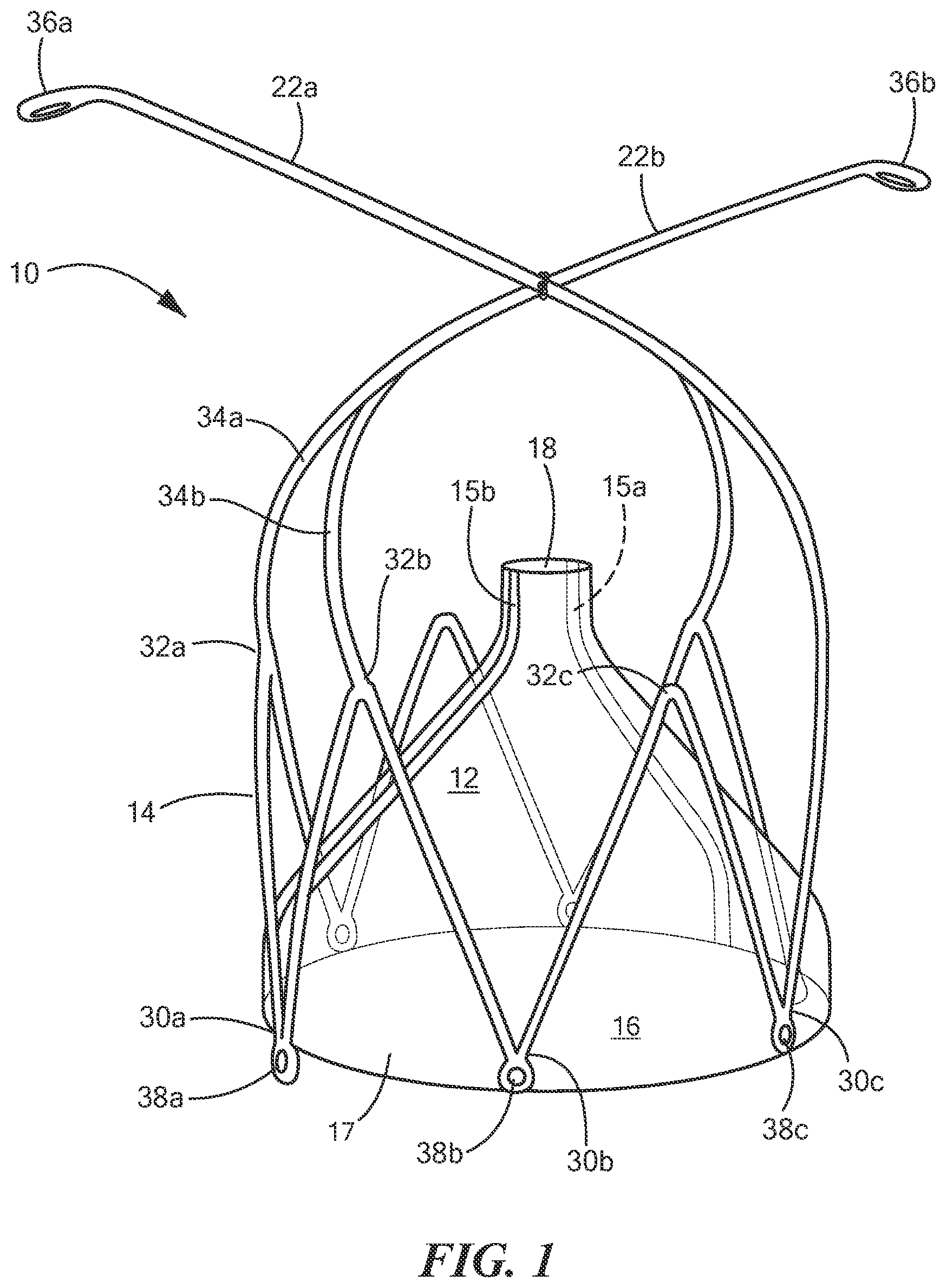Patent US12588909 — Transcatheter device and minimally invasive method for constricting and adjusting blood flow through a blood vessel — Figure 1