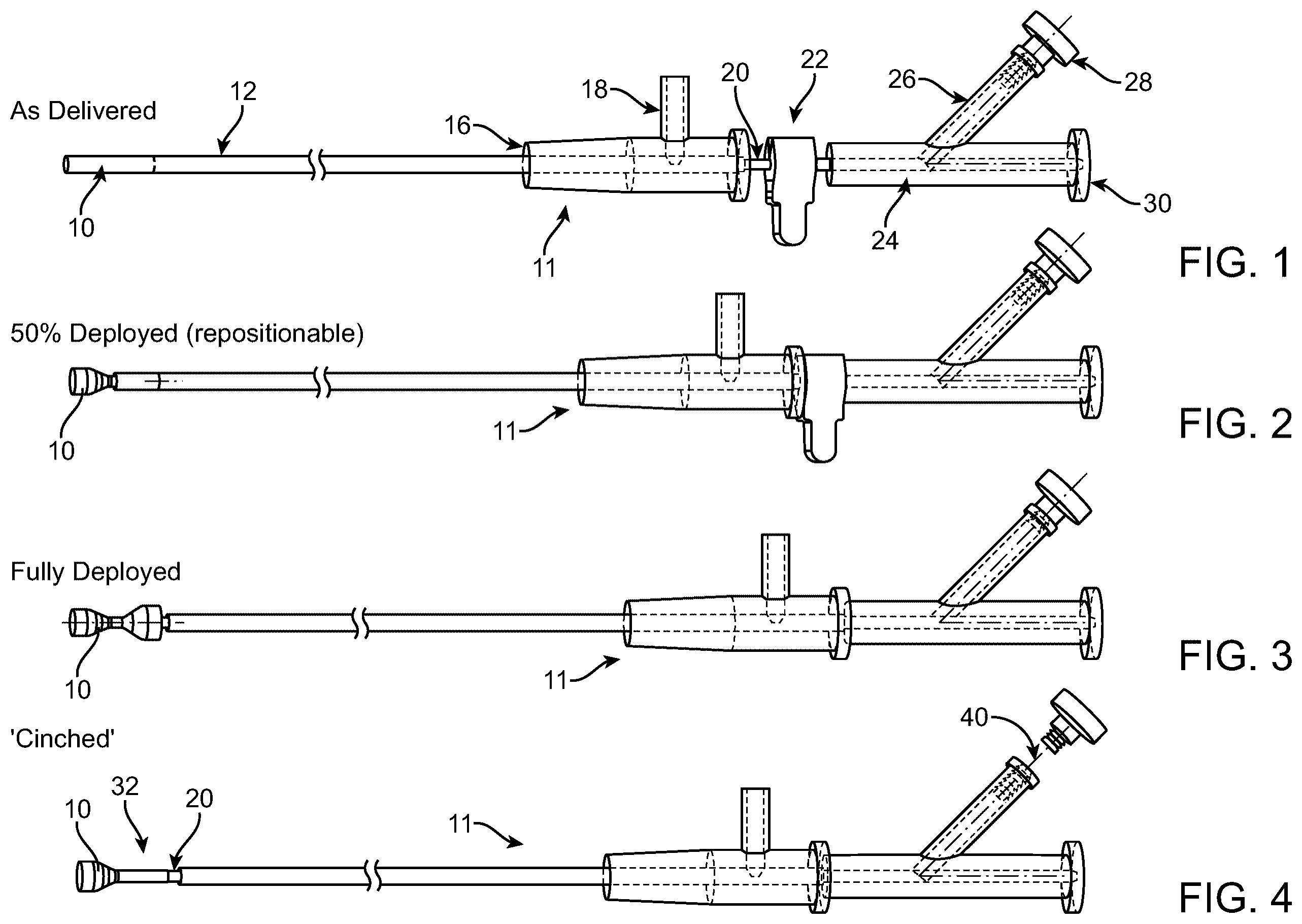 Patent US12588910 — Vascular flow restriction devices and related systems and methods — Figure 1