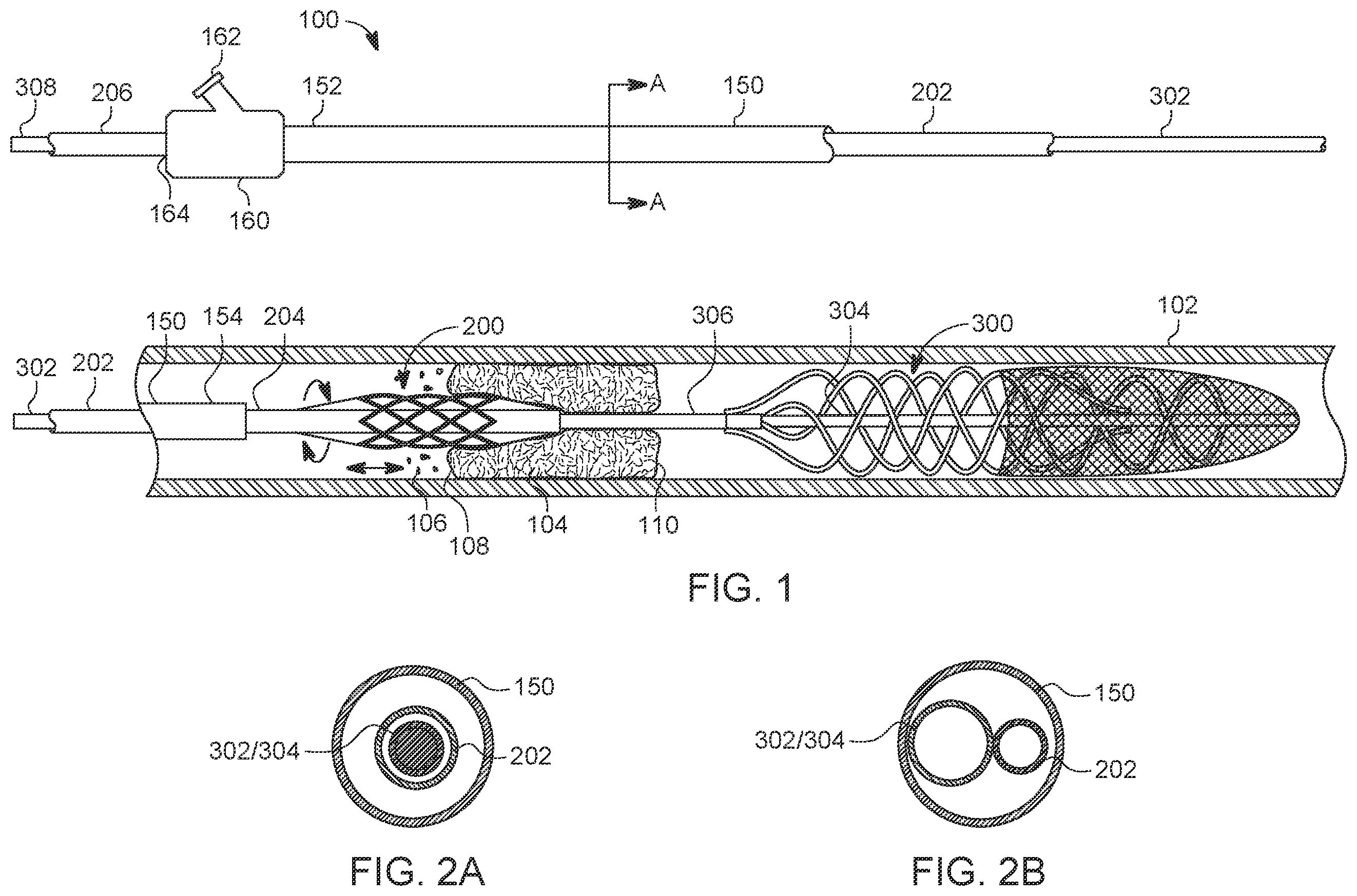 Patent US12588925 — Deep vein thrombosis thrombectomy device with embolic protection — Figure 1