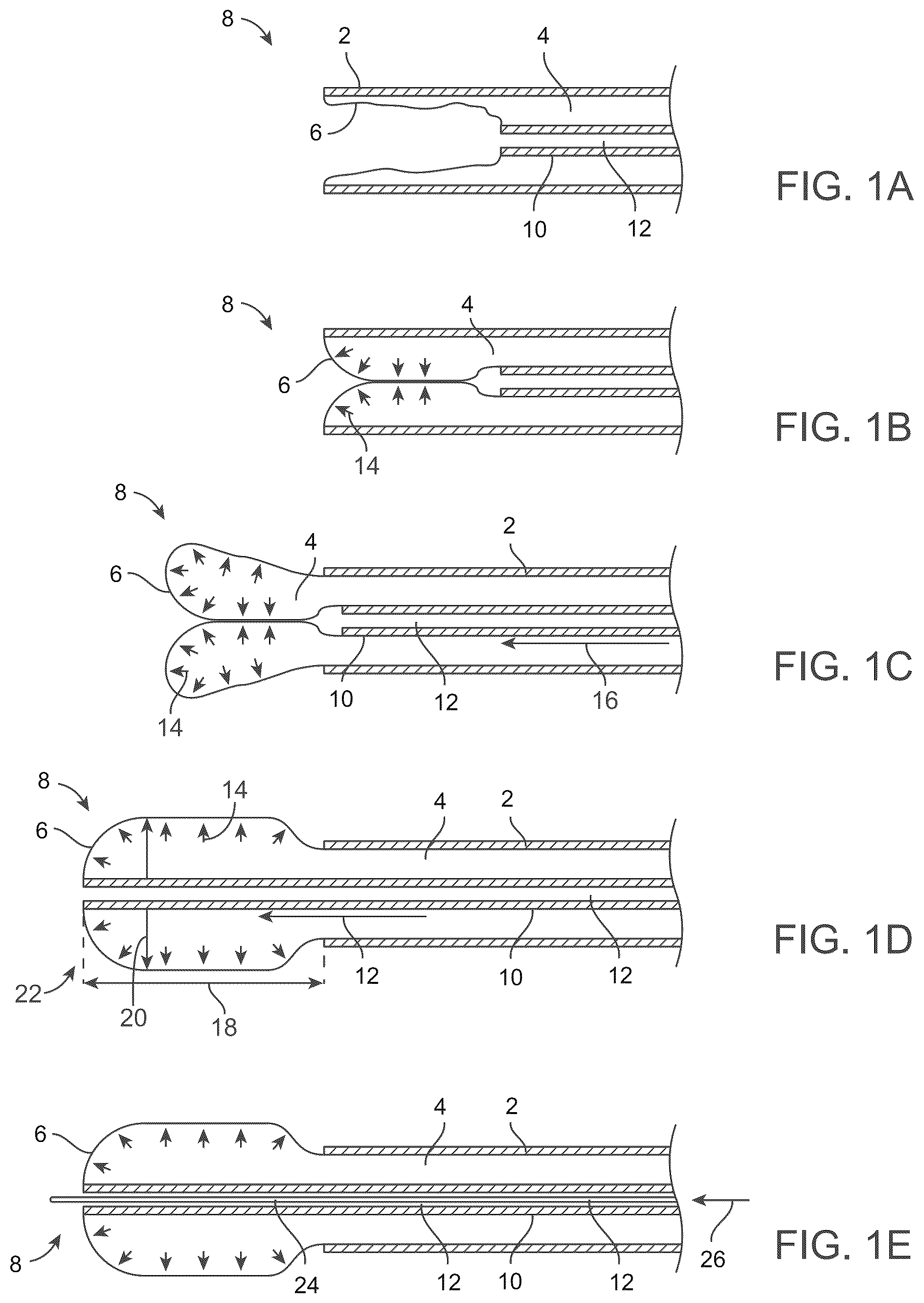 Patent US12588929 — Apparatus and method for everting catheter for embryo transfer using transvaginal ultrasound — Figure 1