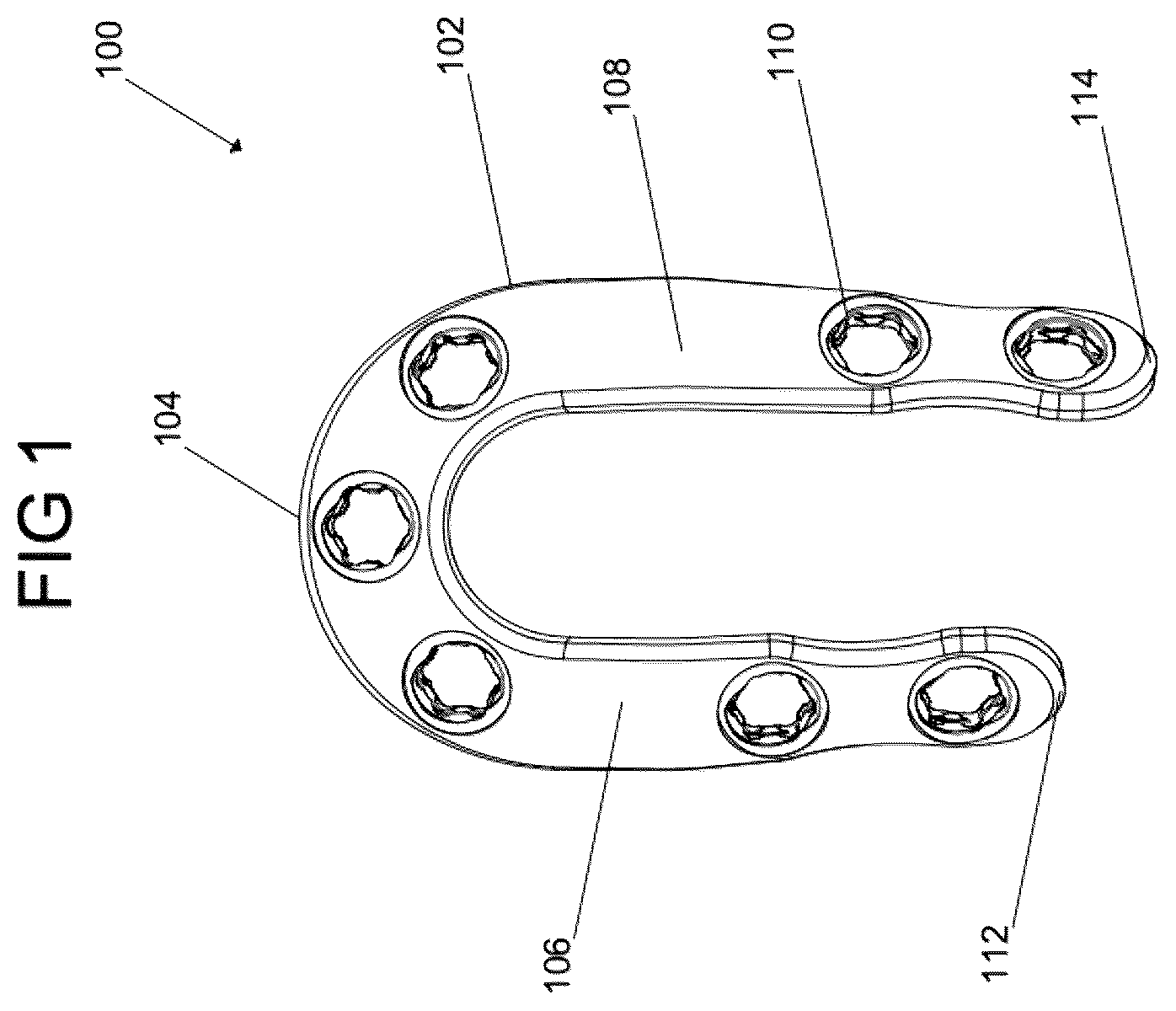 Patent US12588932 Figure 1 – Multi-planar fixation system