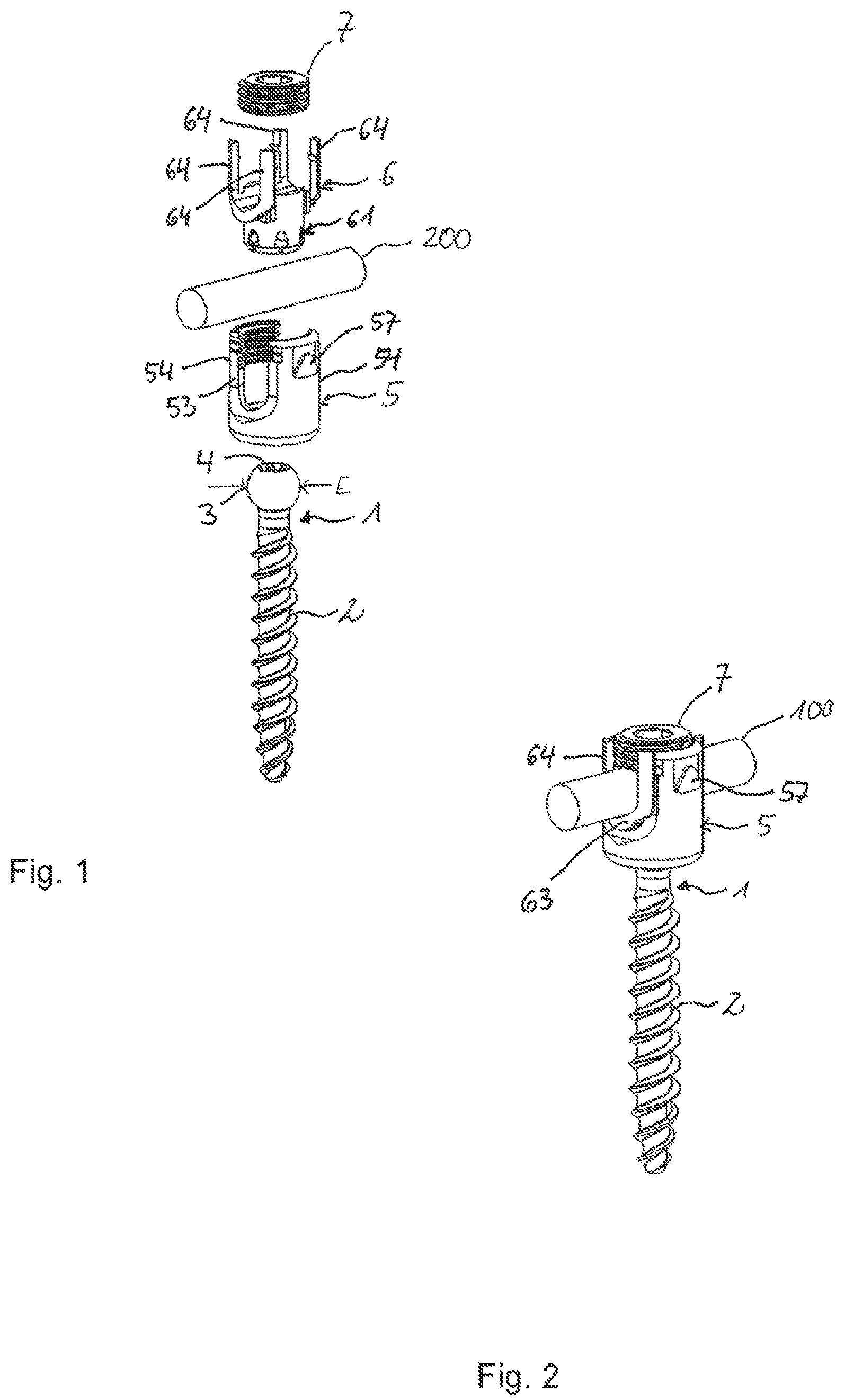 Patent US12588933 — Coupling device for coupling a rod to a bone anchor — Figure 1