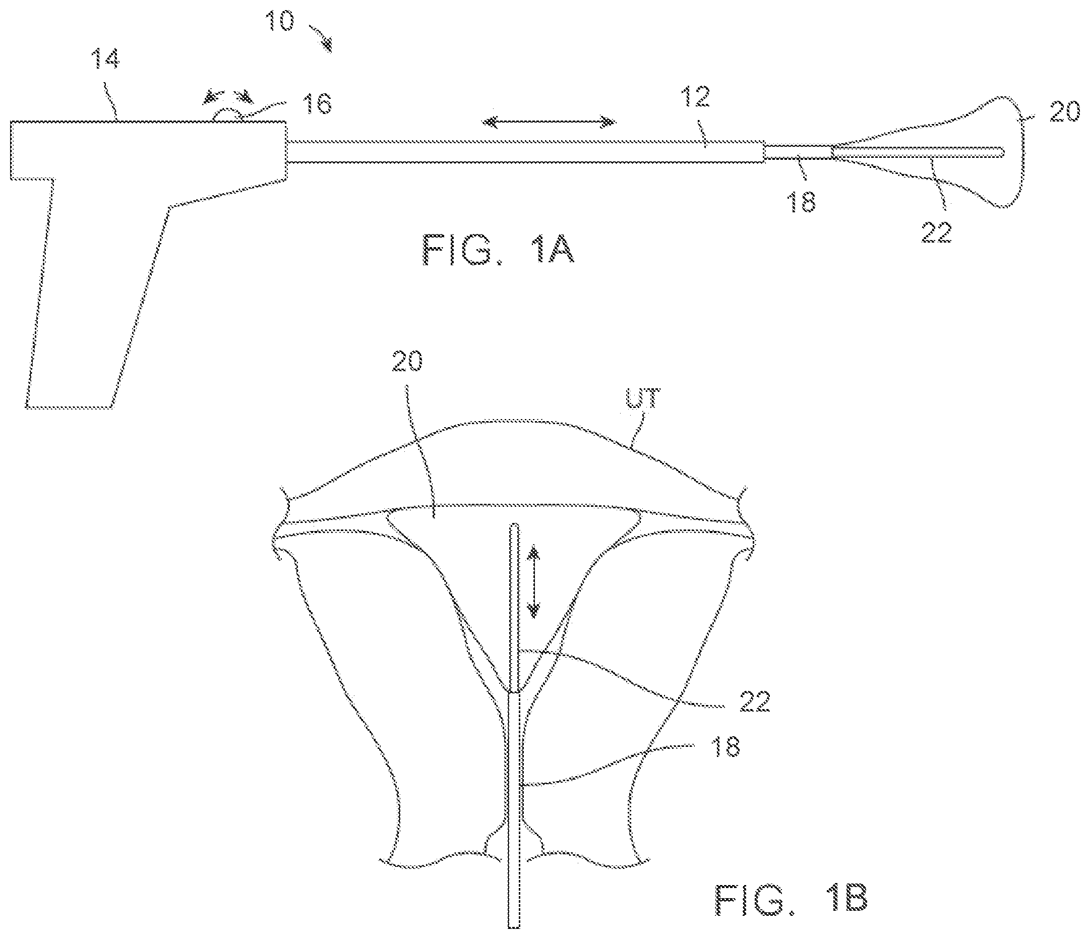 Patent US12588939 — Apparatus and methods for regulating cryogenic treatment — Figure 1