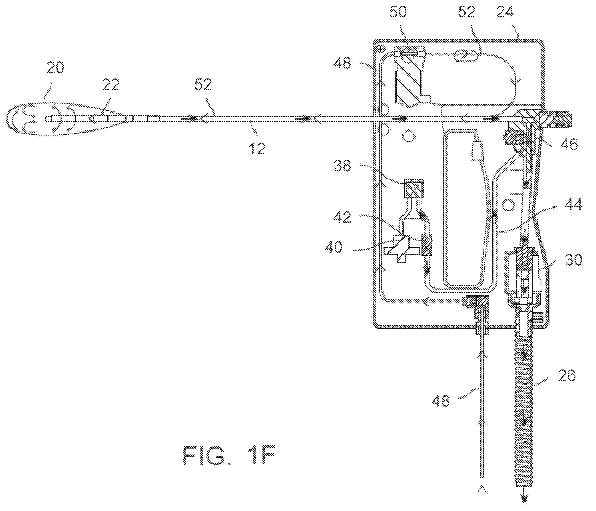 Patent US12588939 Figure 4 – Apparatus and methods for regulating cryogenic treatment