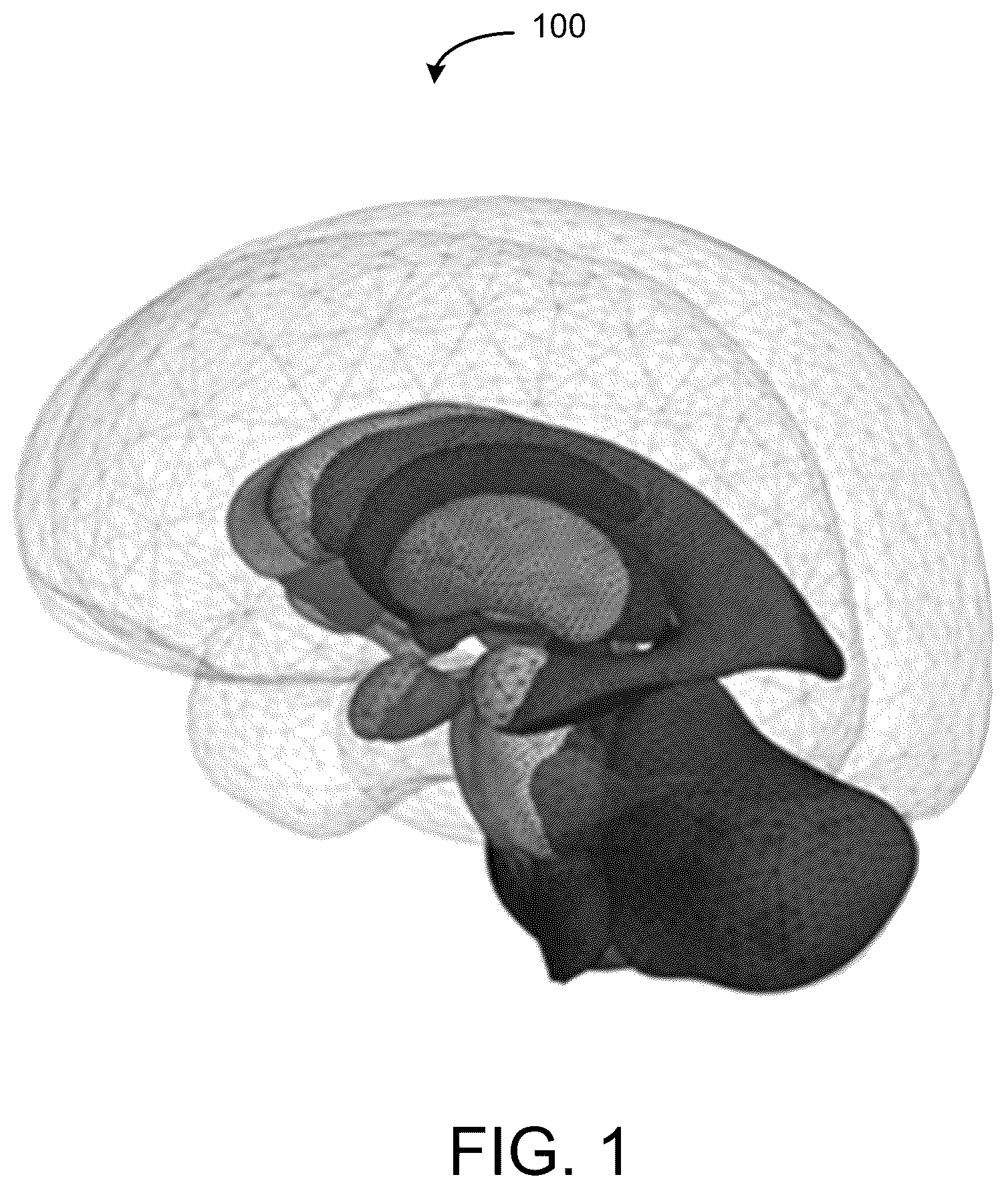 Patent US12588950 — Trajectory planning for minimally invasive therapy delivery using local mesh geometry — Figure 1