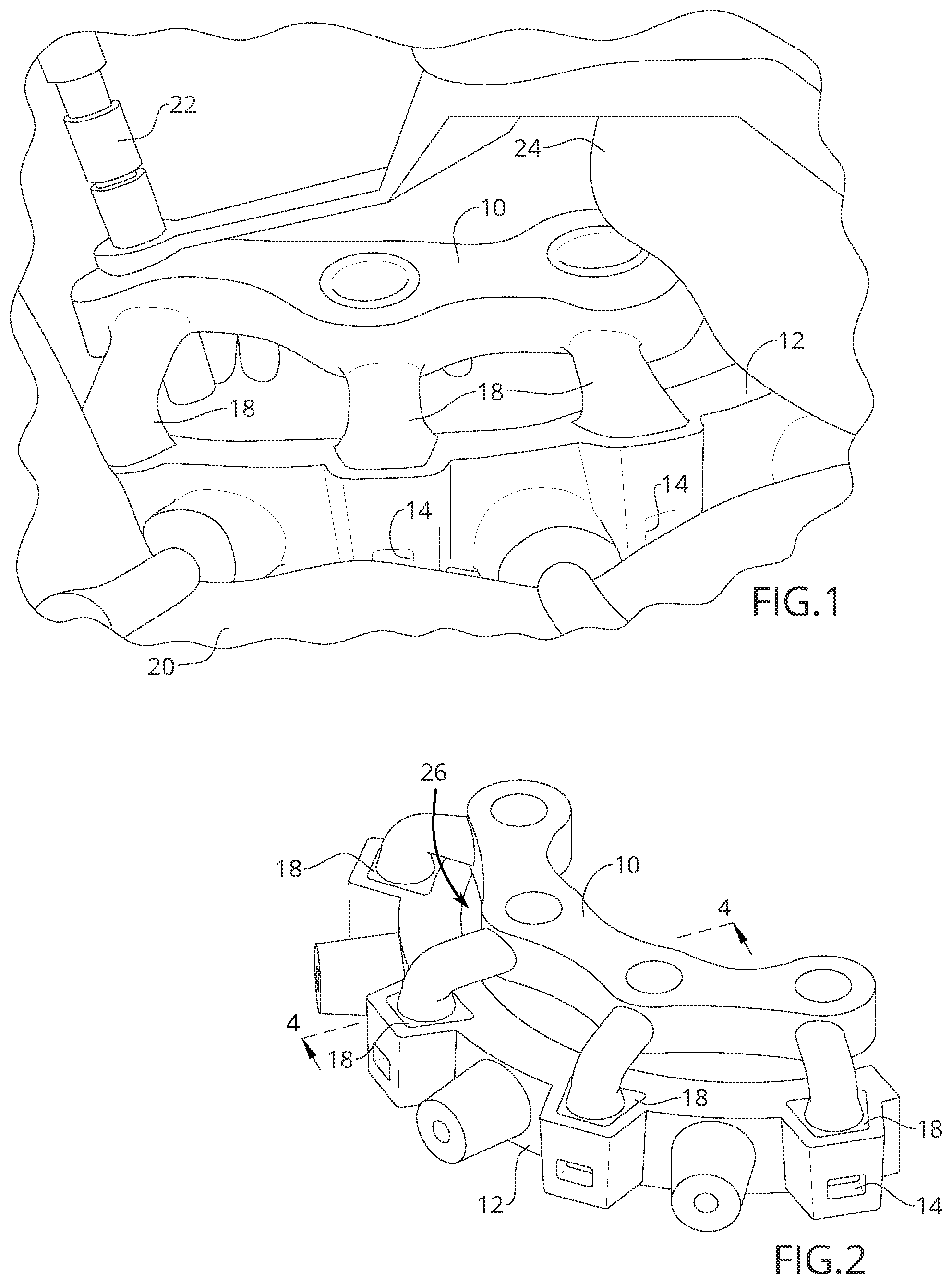 Patent US12588970 — Surgical guide with mating connectors — Figure 1