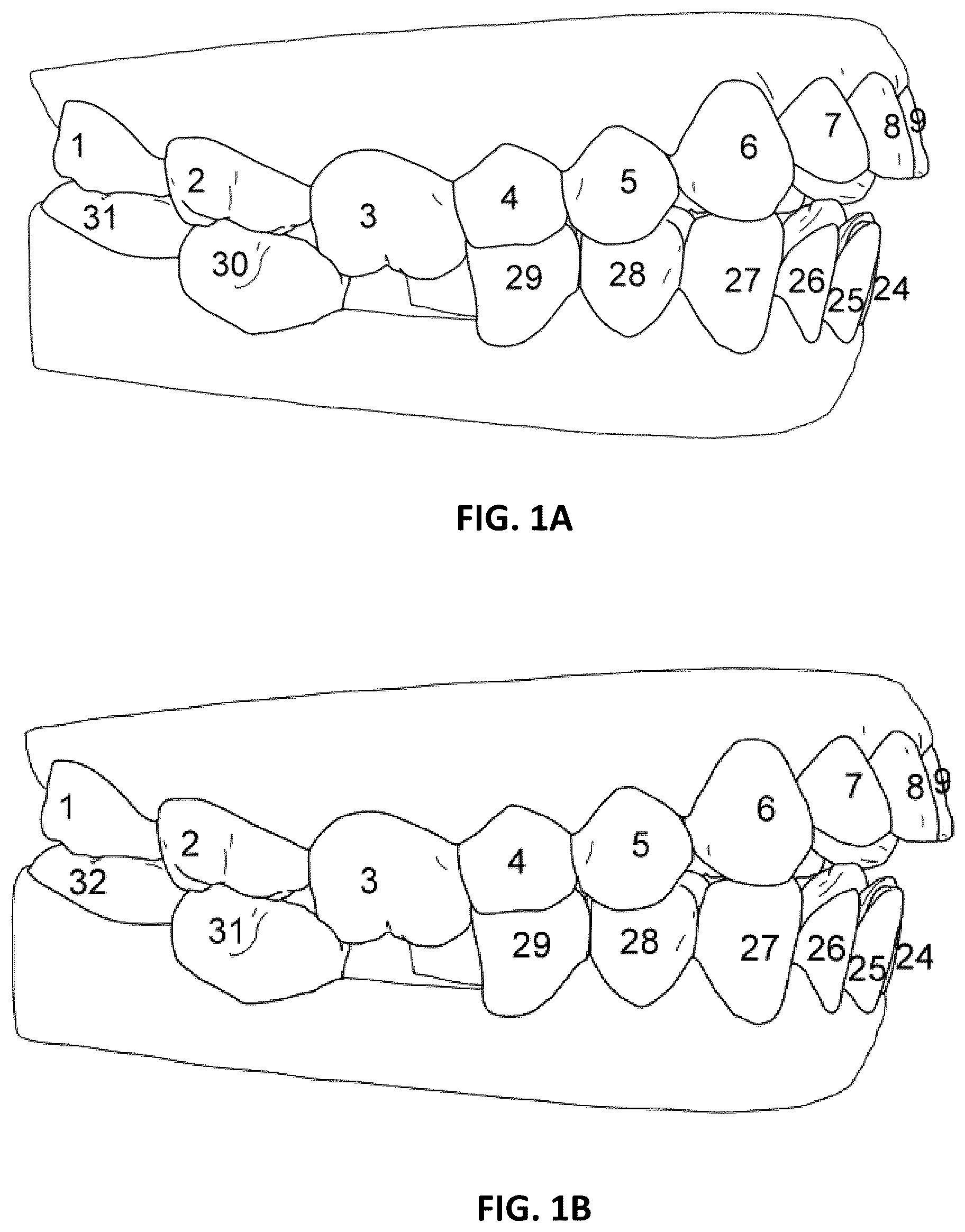 Patent US12588972 — Dental analysis with missing teeth prediction — Figure 1