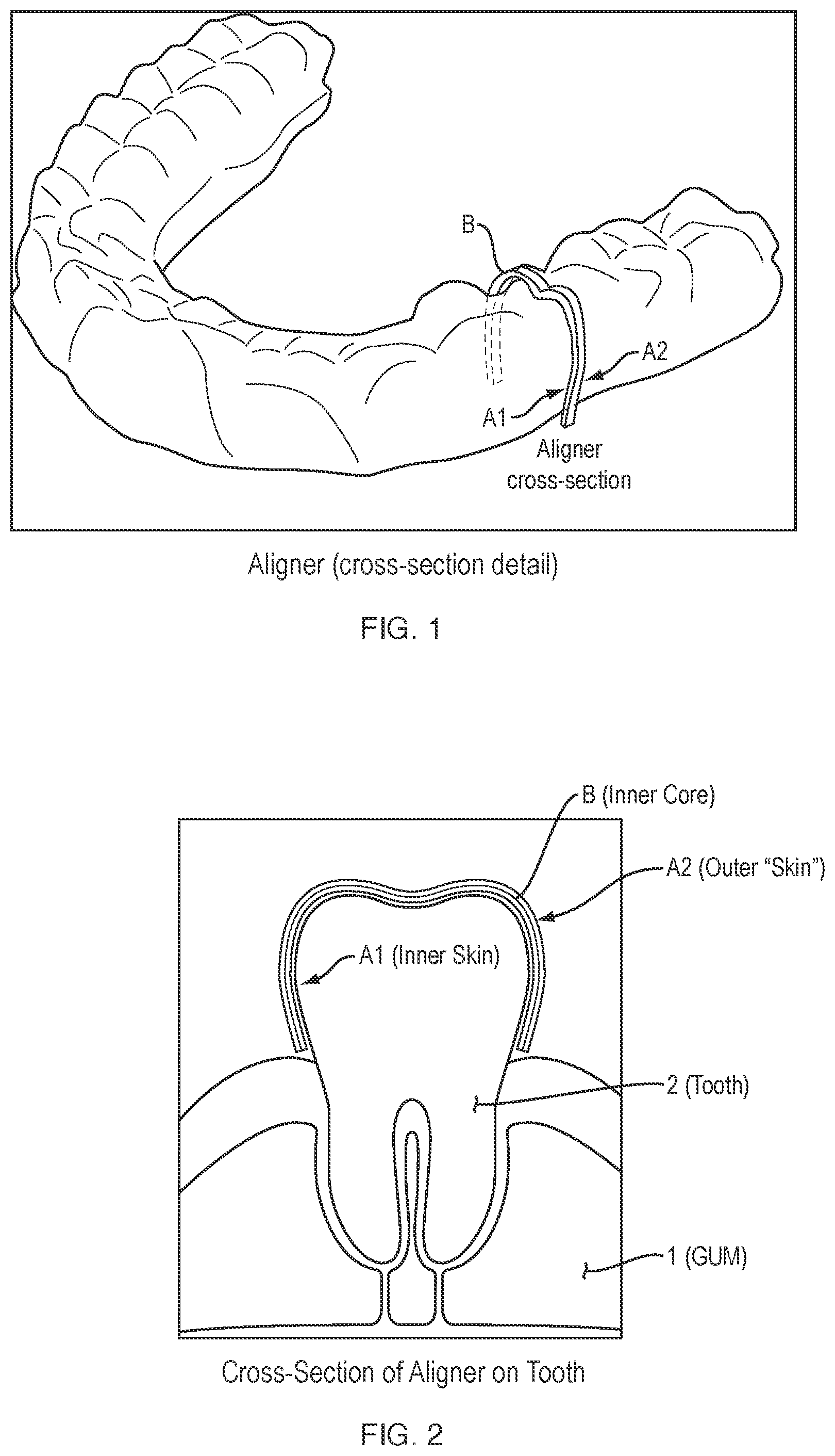 Patent US12588977 Figure 1 – Dental aligner