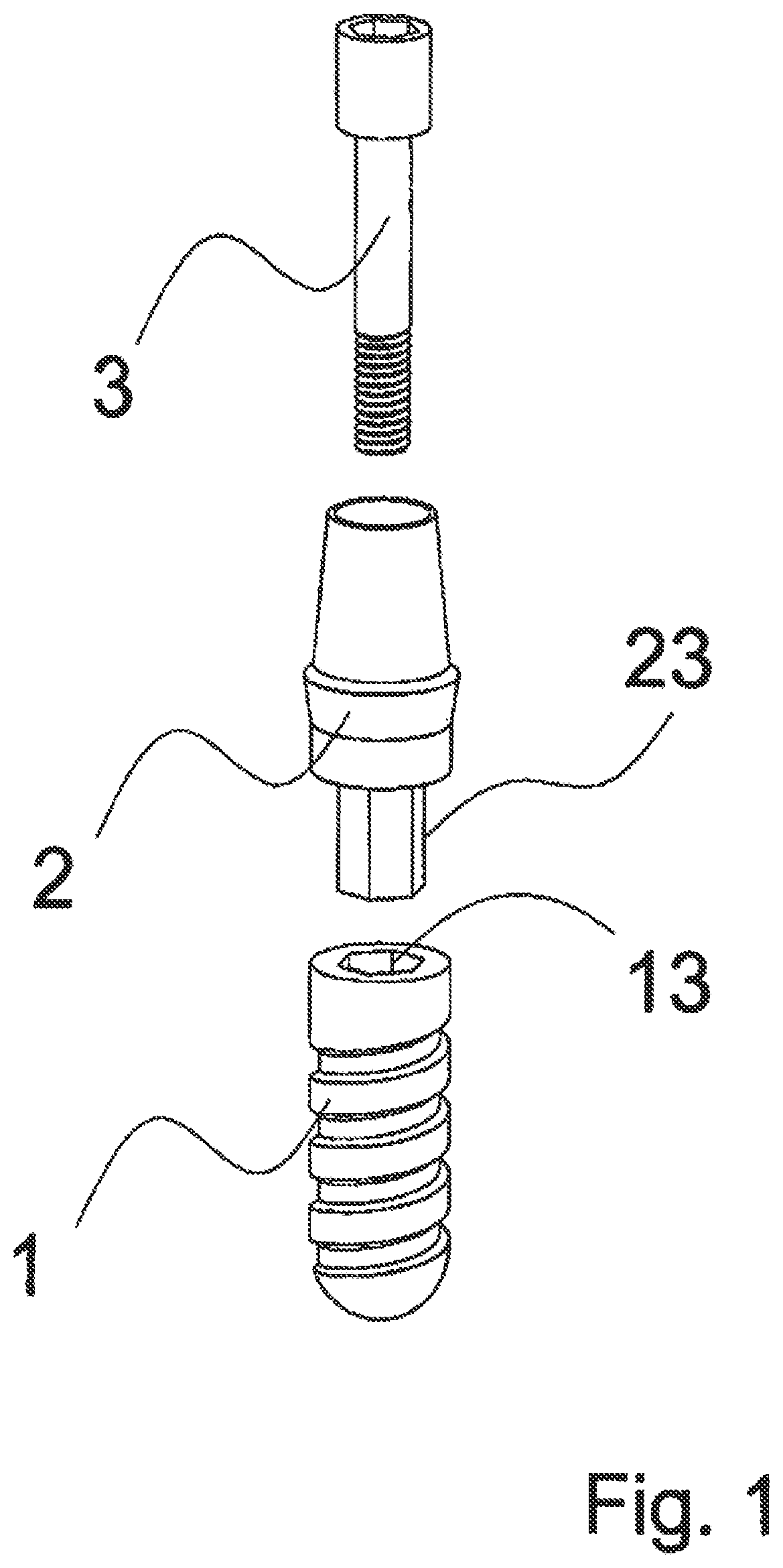 Patent US12588983 Figure 1 – Dental implant with indexing surfaces having a friction-reducing coating