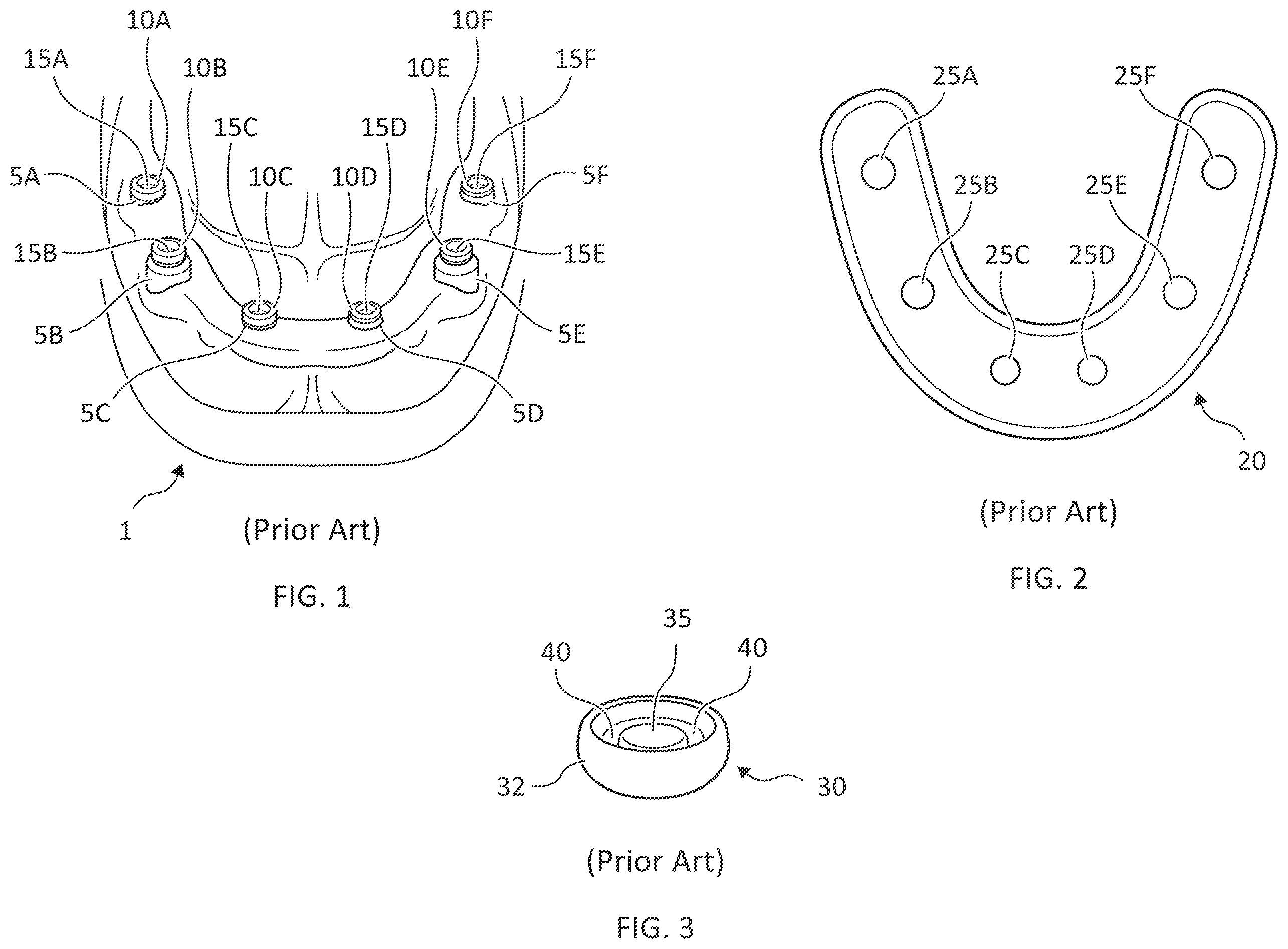 Patent US12588984 — Dental apparatus and methods — Figure 1