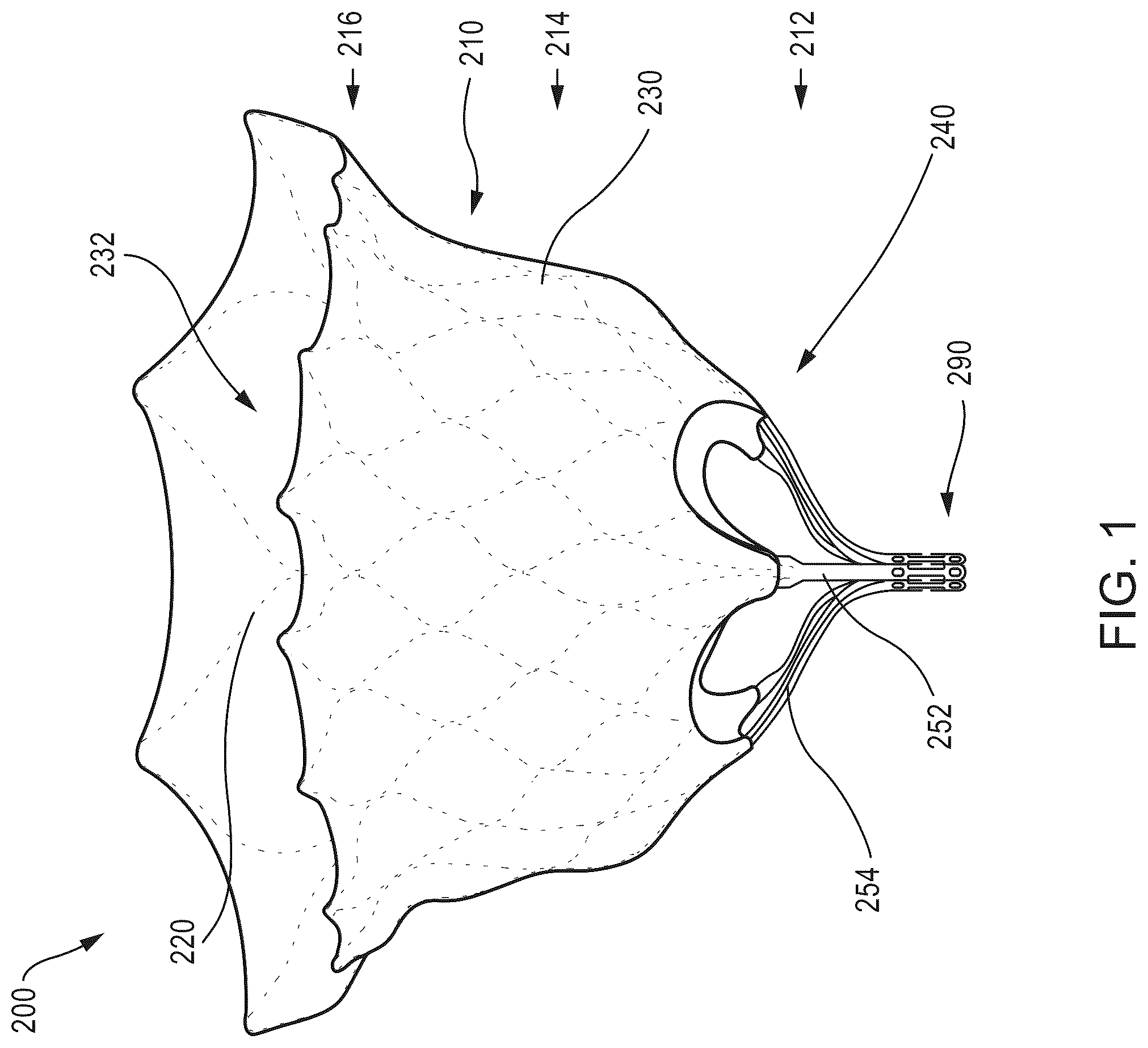 Patent US12588986 — Apparatus and methods for anterior valve leaflet management — Figure 1