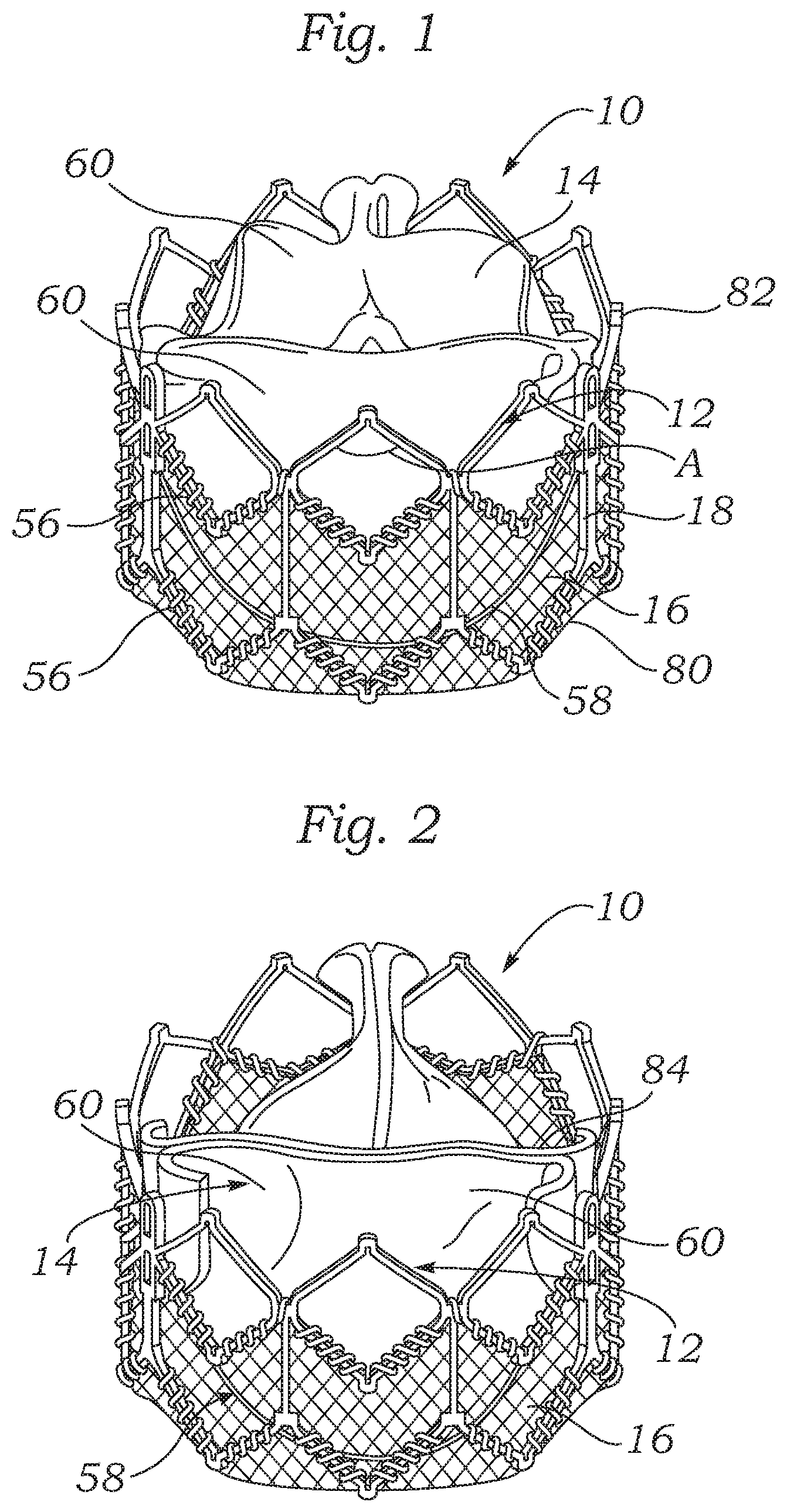 Patent US12588987 — Low profile transcatheter heart valve — Figure 1