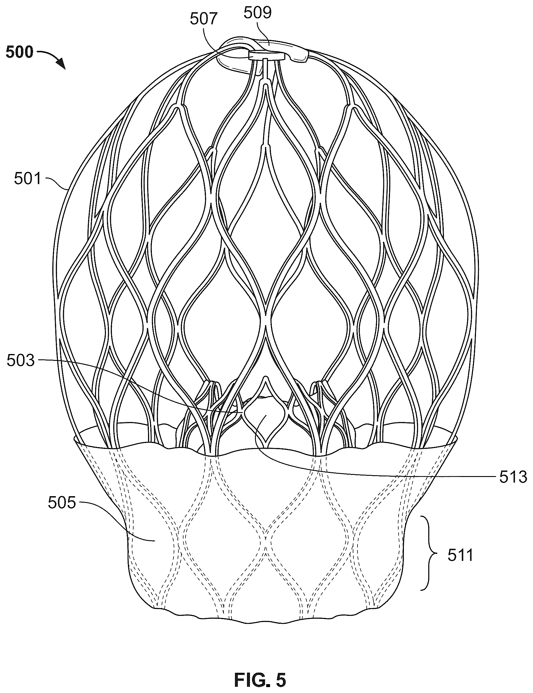 Patent US12588989 Figure 5 – Implant delivery