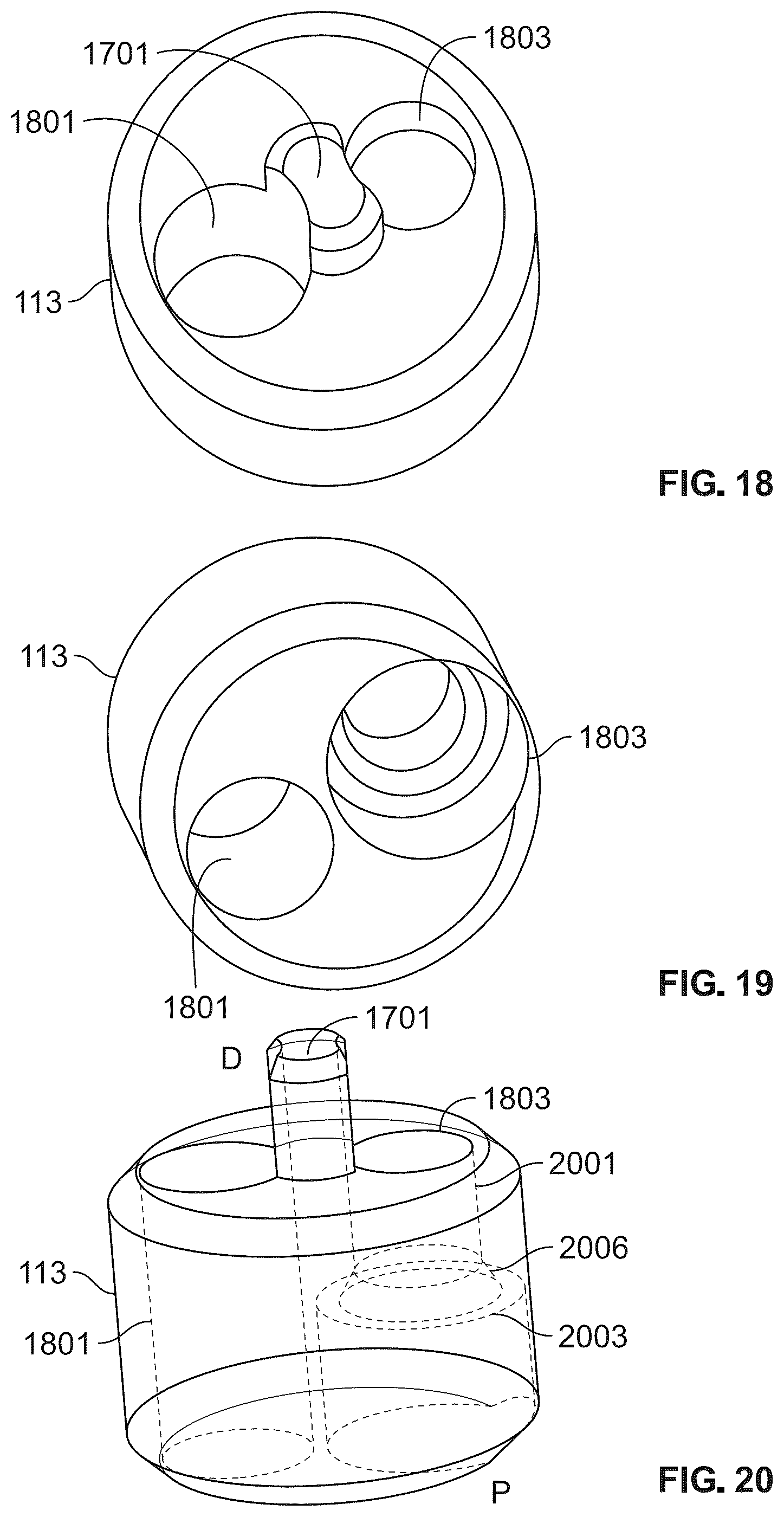 Patent US12588989 Figure 15 – Implant delivery
