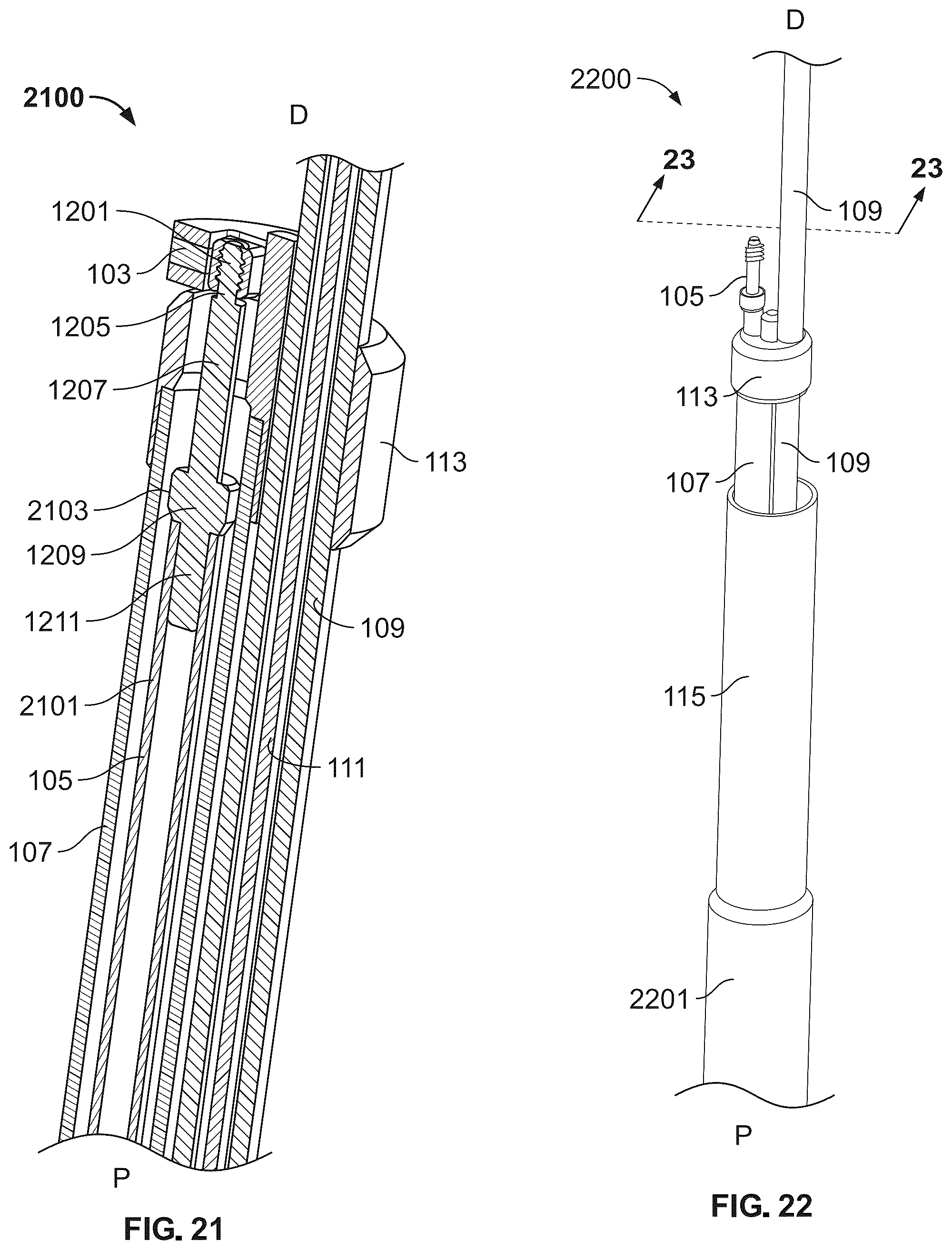 Patent US12588989 Figure 16 – Implant delivery