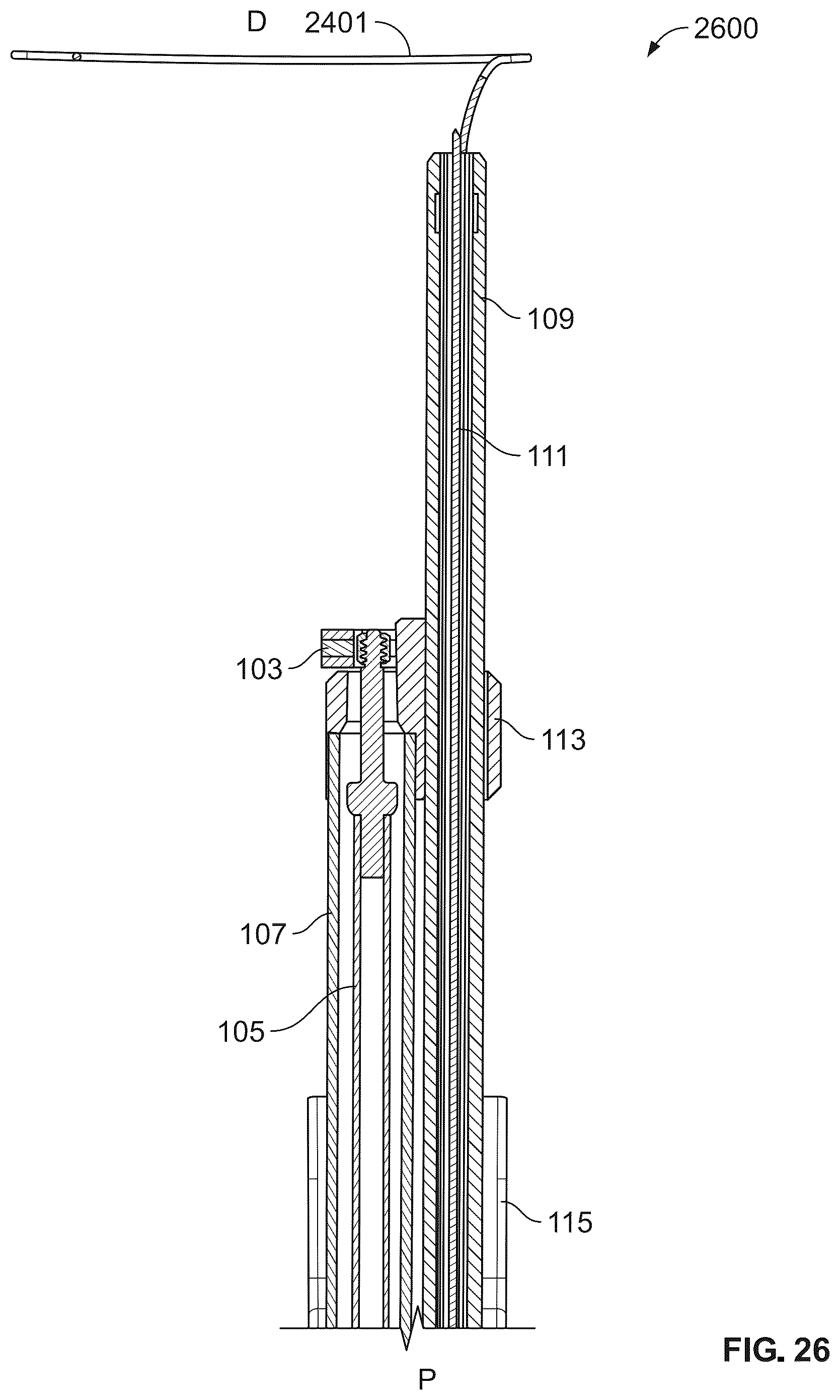 Patent US12588989 Figure 19 – Implant delivery