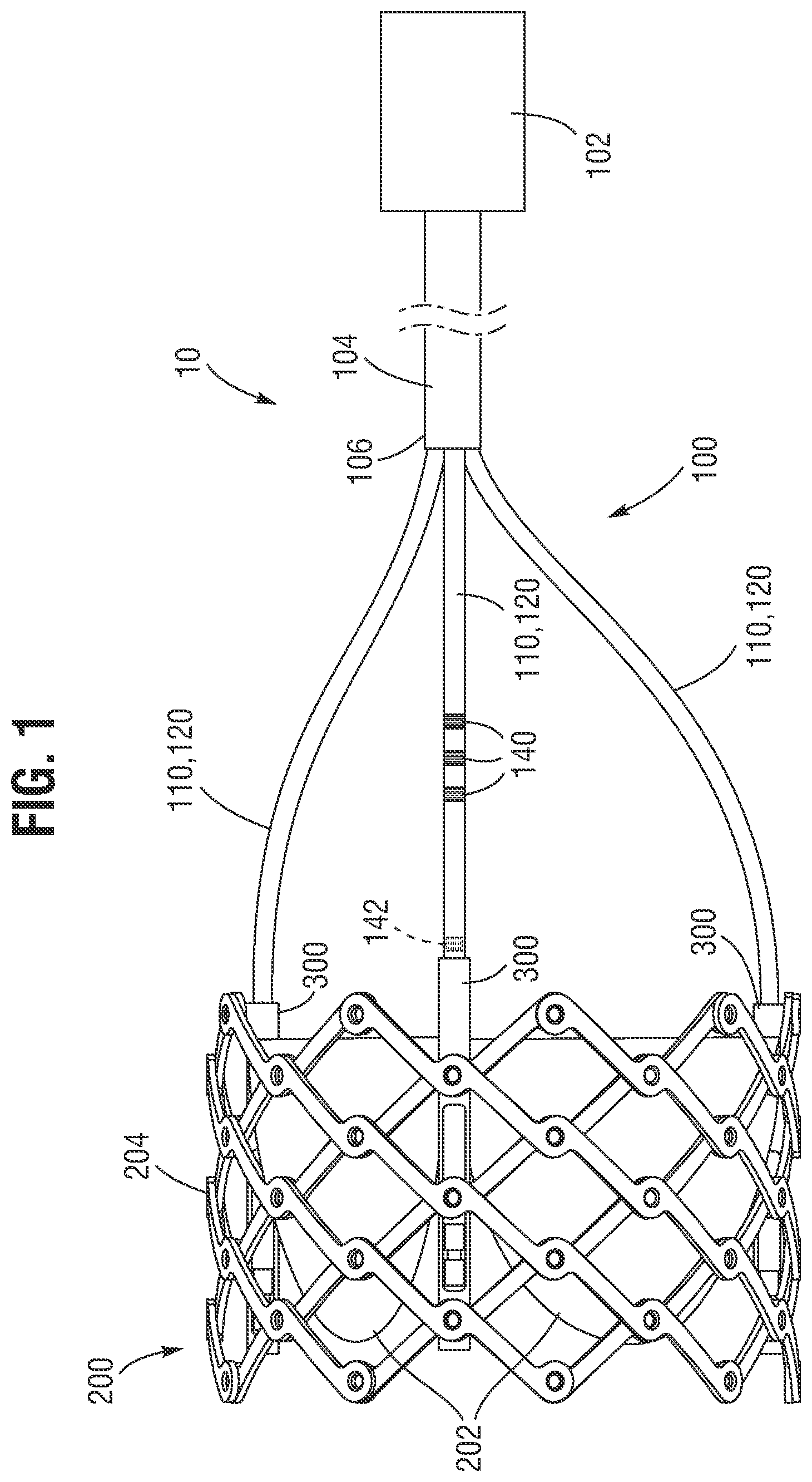 Patent US12588991 Figure 1 – Apparatus and method for monitoring valve expansion