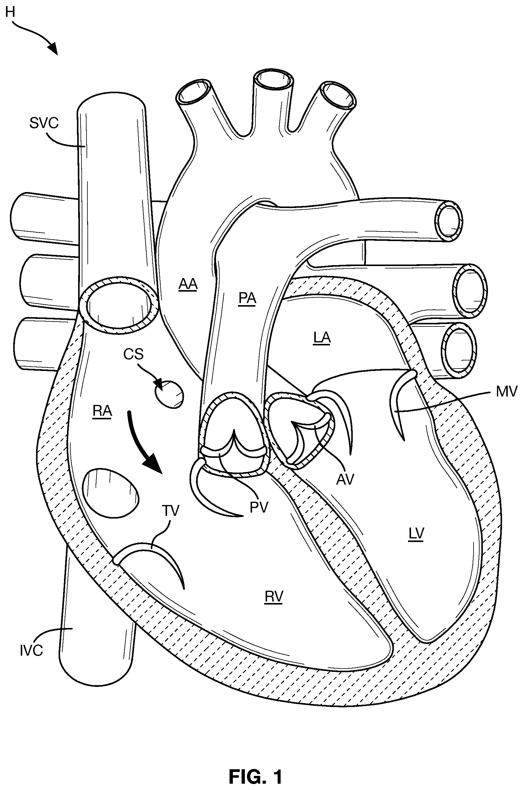 Patent US12588997 — Heart valve sealing devices and delivery devices therefor — Figure 1