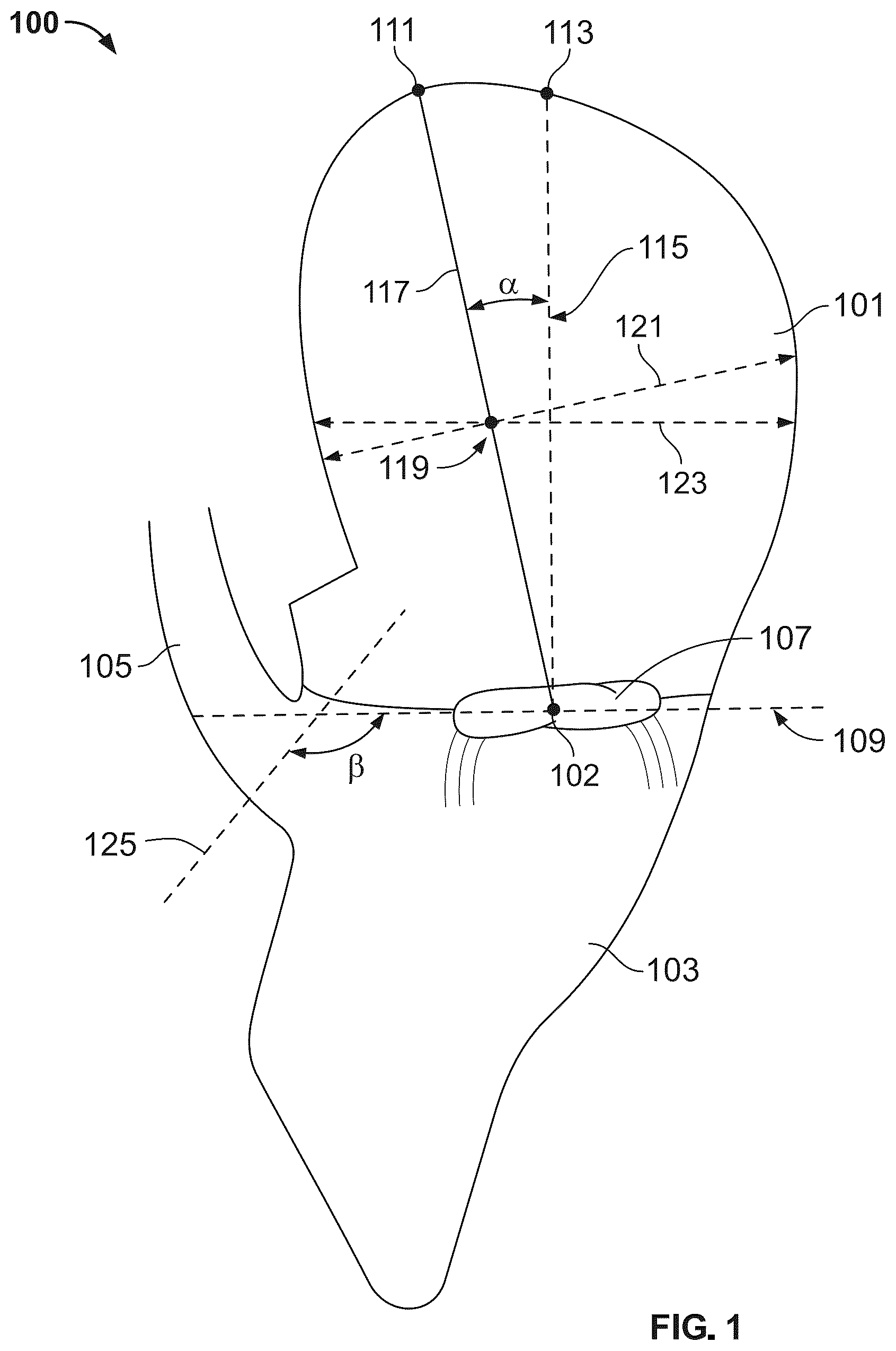 Patent US12588998 — Prosthetic heart valve for natural blood flow — Figure 1