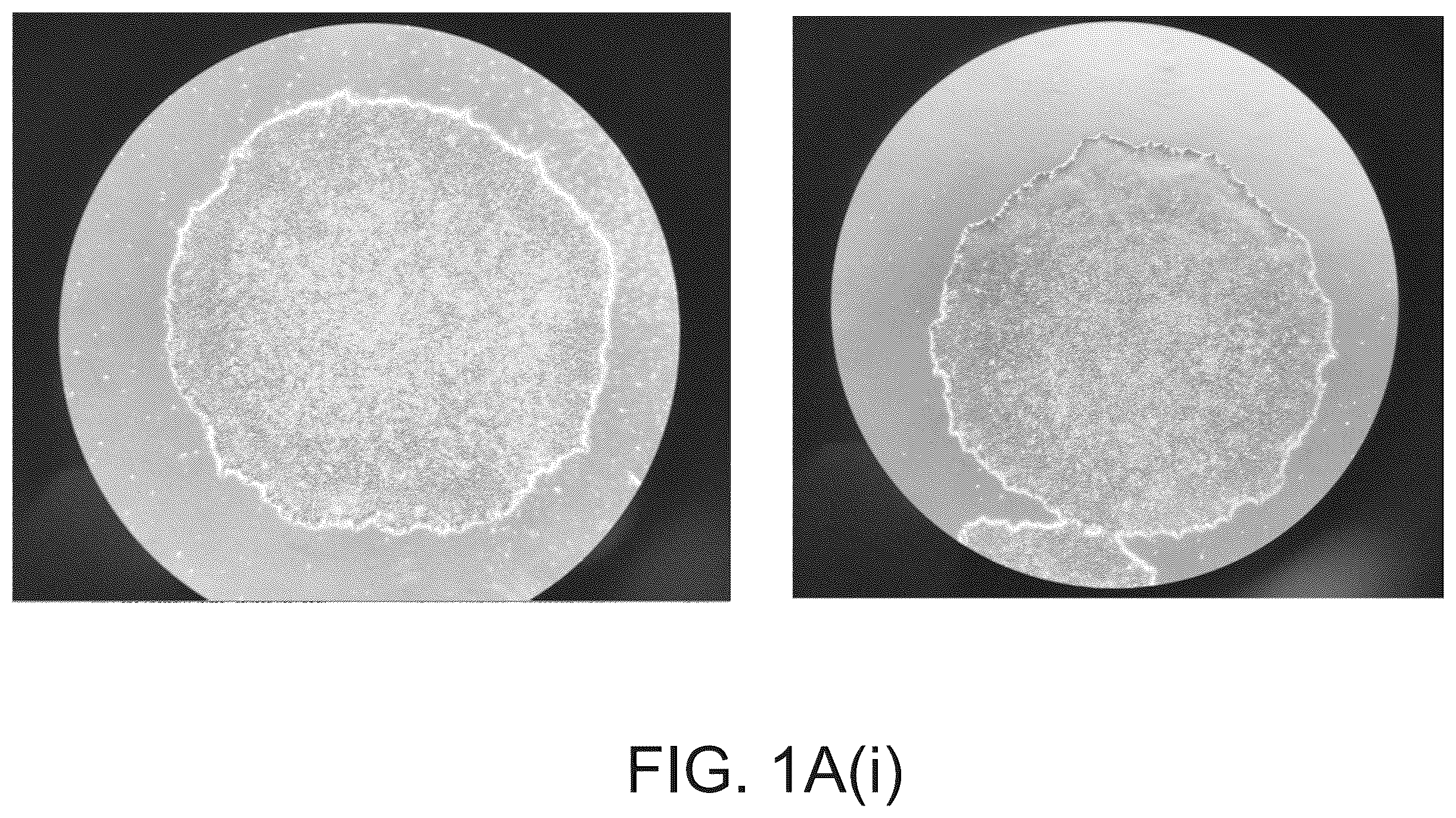 Patent US12590320 — Cellular models of and therapies for ocular diseases — Figure 1