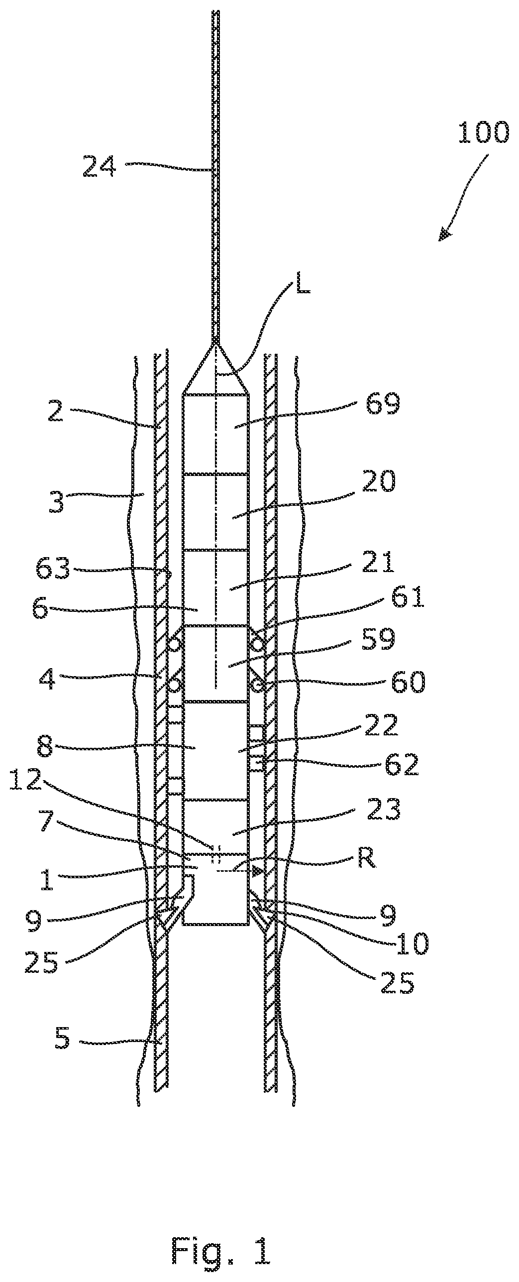 Patent US12590499 — Downhole tubing intervention tool — Figure 1
