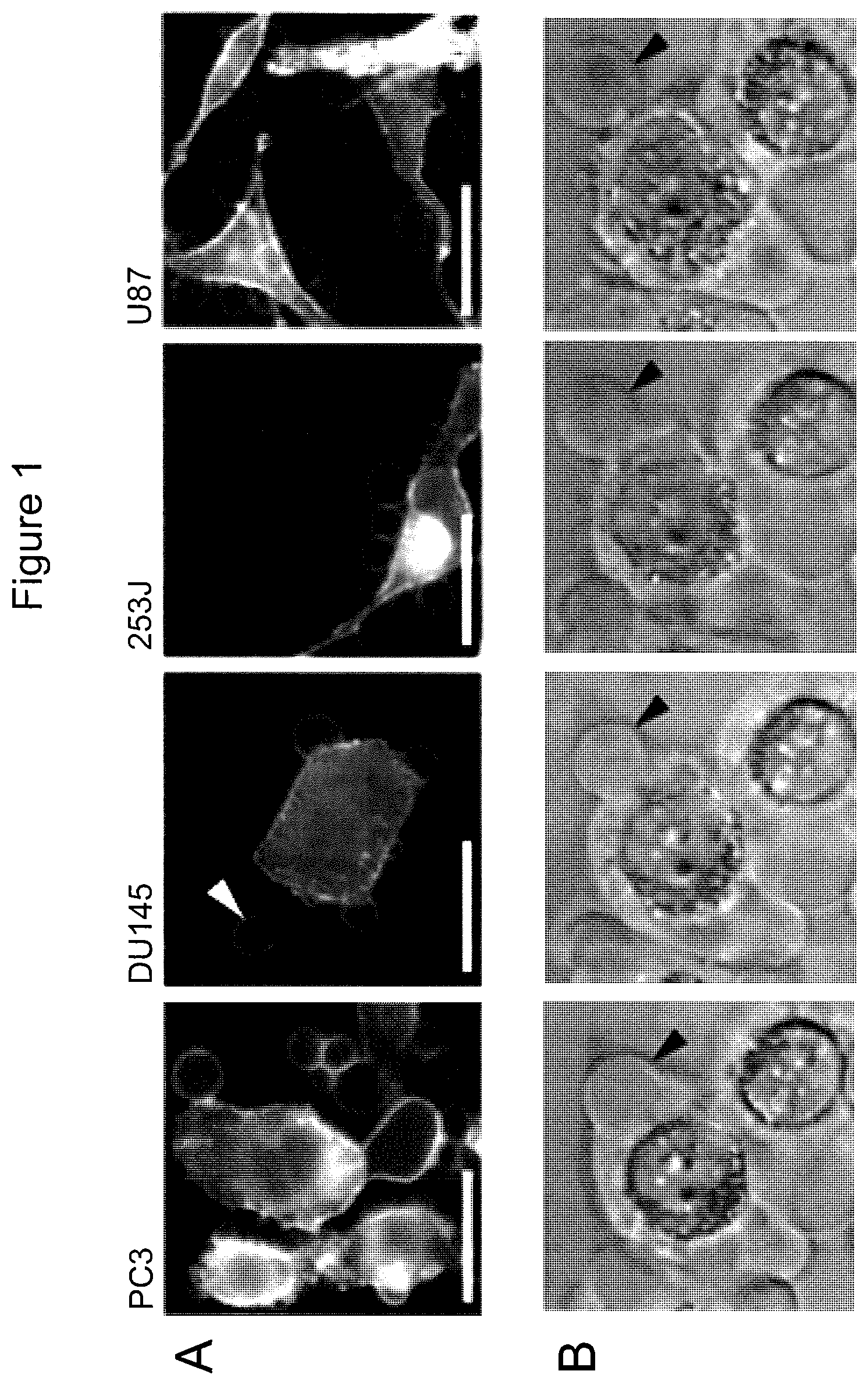 Patent US12590965 — Palmitoyl protein biomarkers in purified extracellular vesicles for early identification of clinically significant prostate cancer — Figure 1