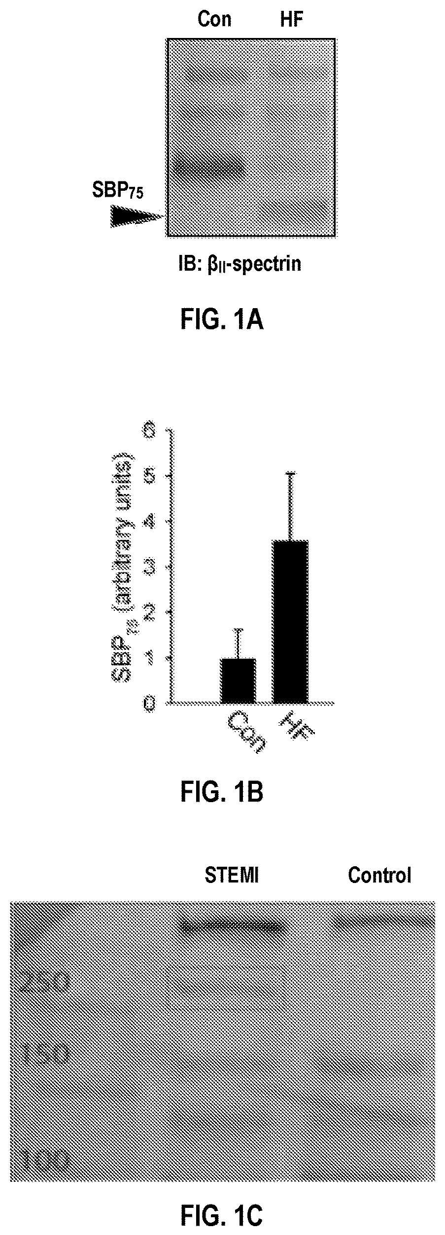 Patent US12590974 — Methods and compositions for cardiovascular disease detection and management — Figure 1