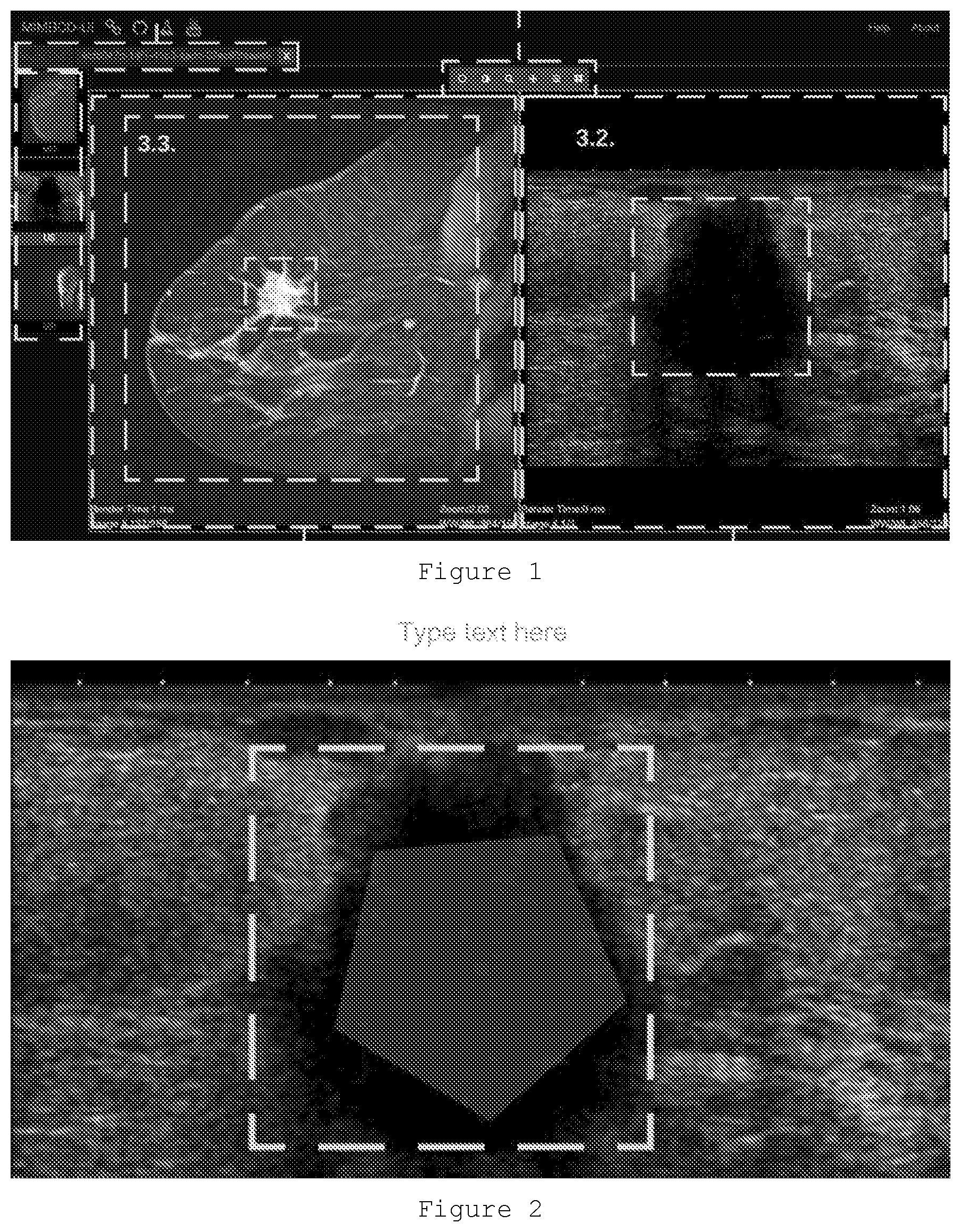 Patent US12591964 — Correlating geometric shapes of segmented regions by at least two different imaging technologies for improved identification of breast lesions — Figure 1