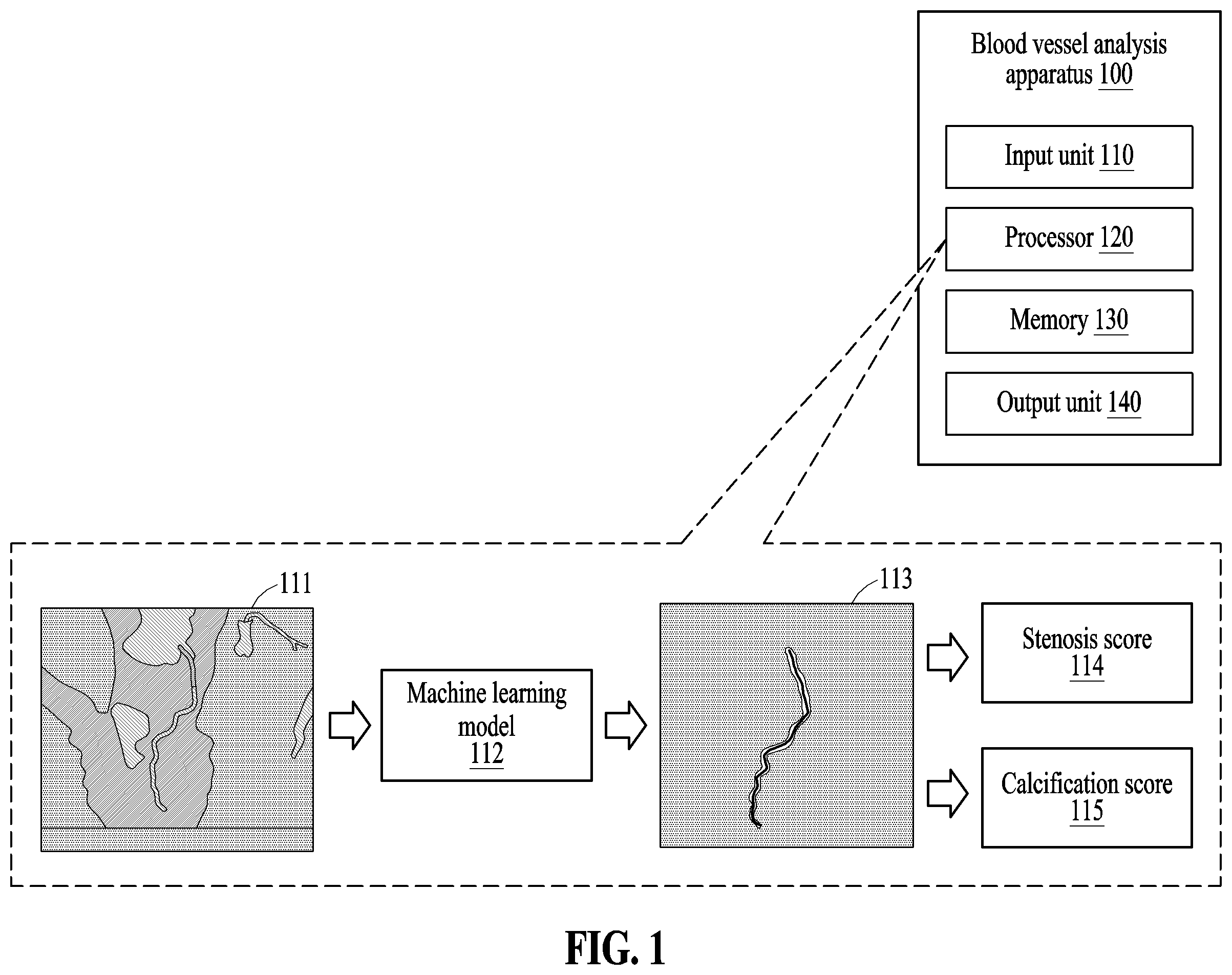 Patent US12591966 — Method and apparatus for analyzing blood vessel based on machine learning model — Figure 1