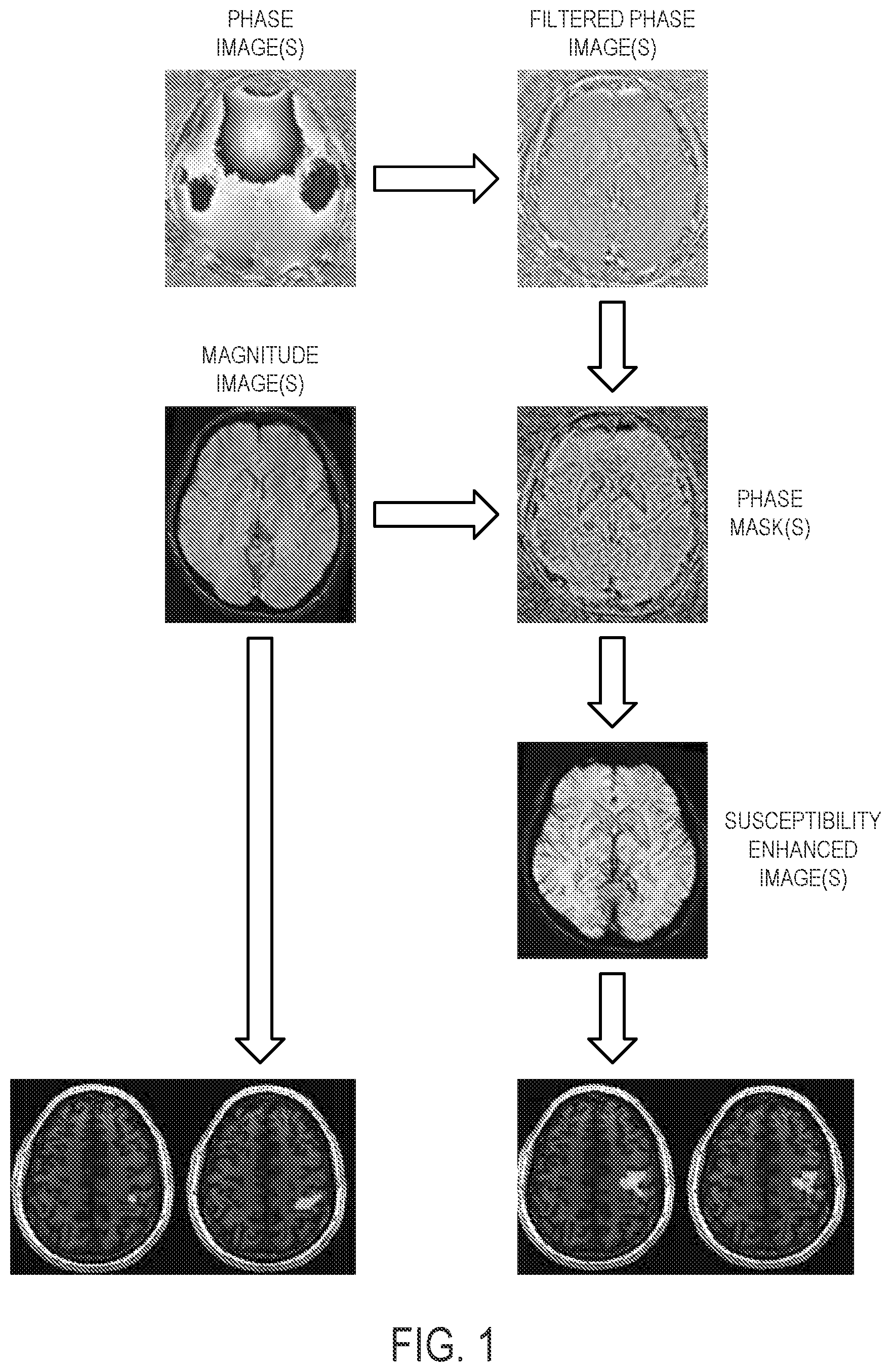 Patent US12592318 — Neuronal activity mapping using phase-based susceptibility-enhanced functional magnetic resonance imaging — Figure 1