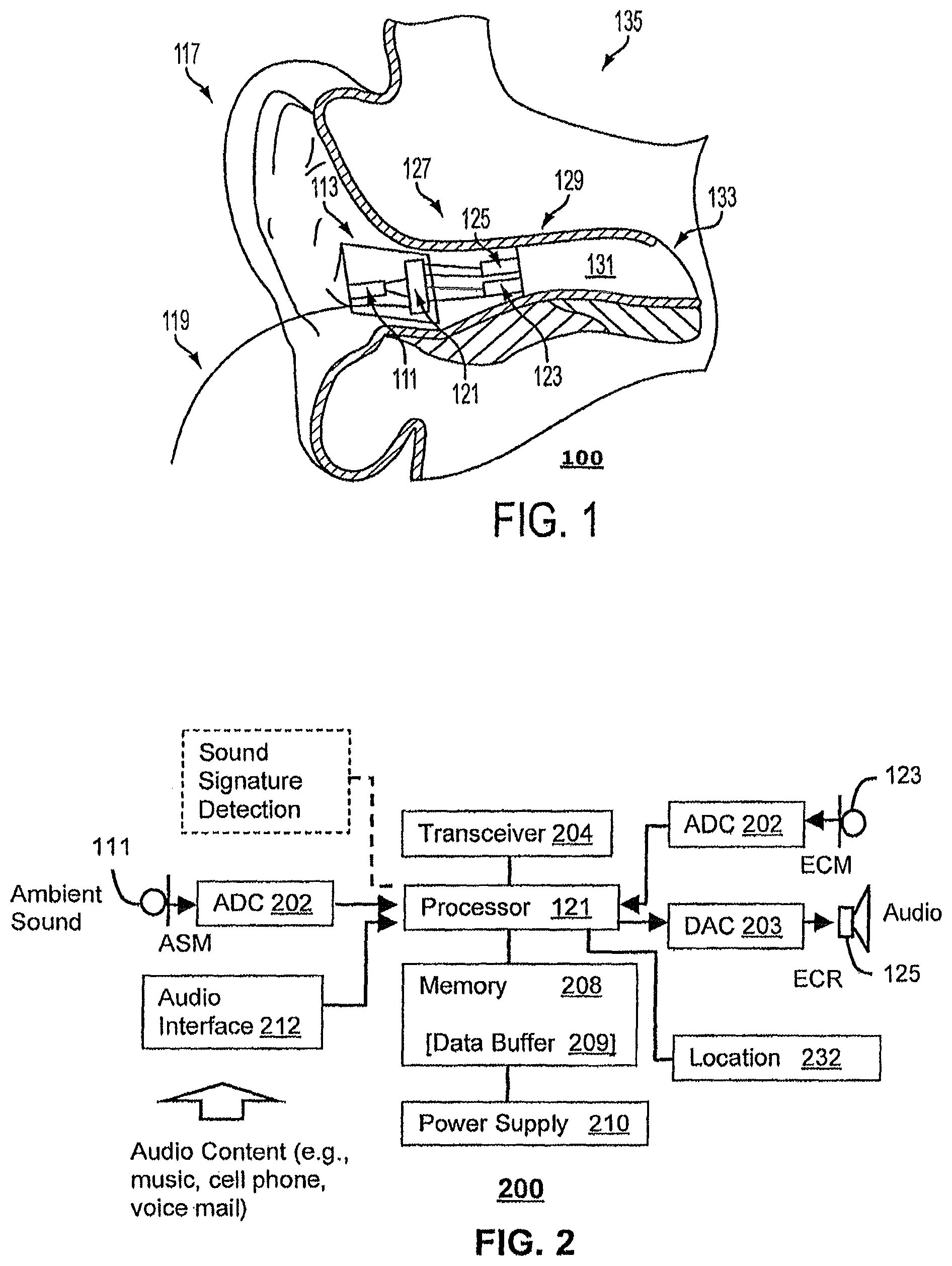 Patent US12597513 — Method and device for audio recording — Figure 1