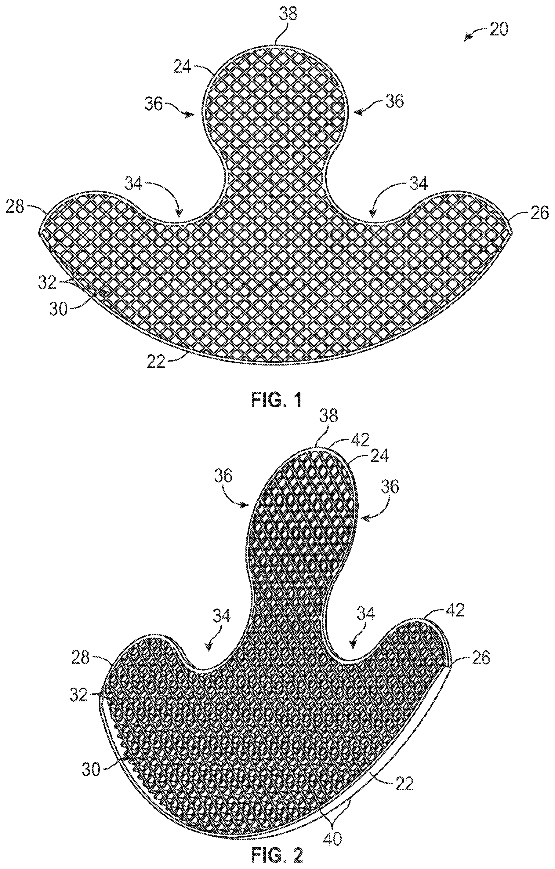 Patent US12599183 Figure 1 – Formed brassiere and associated method of manufacture