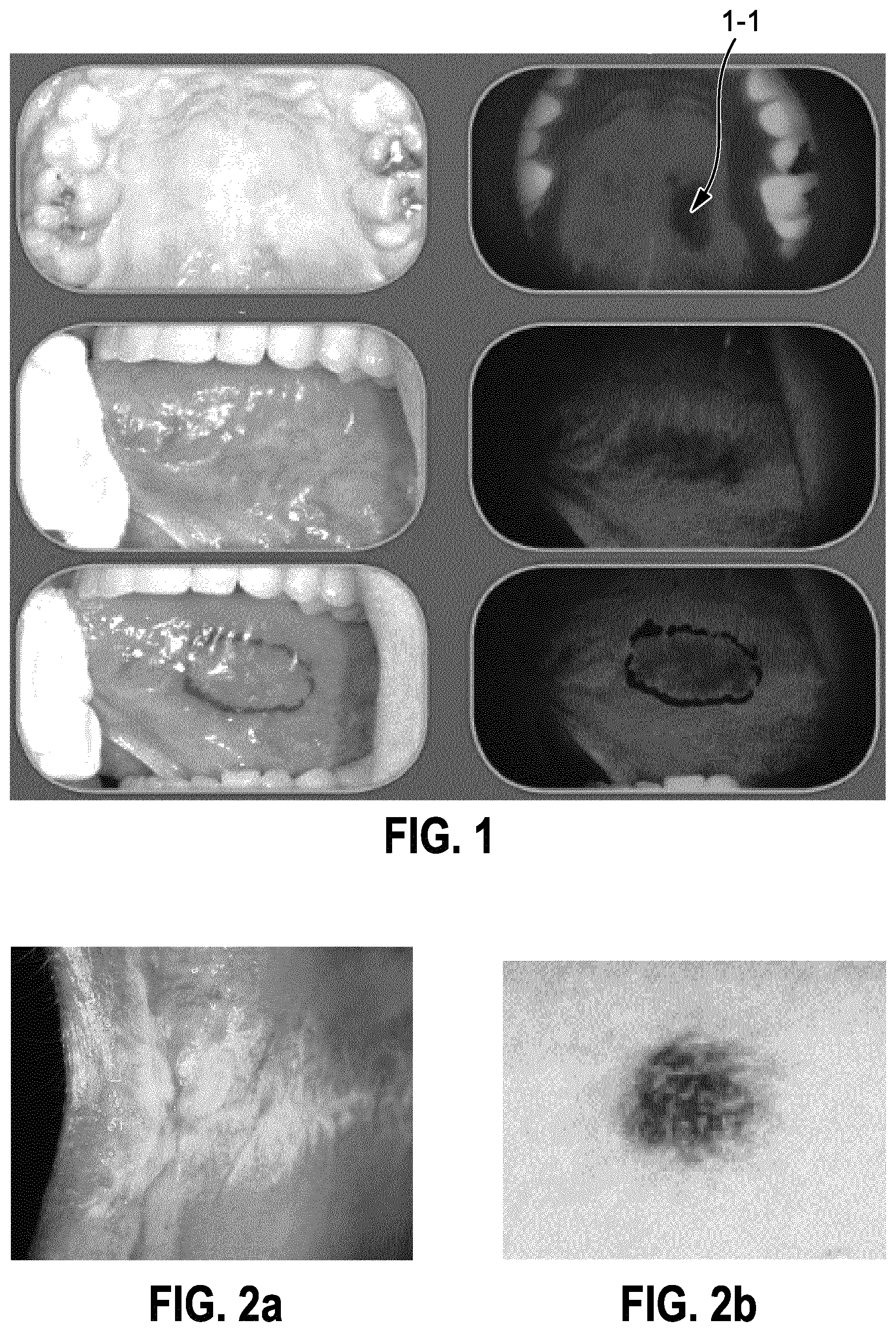 Patent US12599299 — Method and apparatus for multimodal soft tissue diagnostics — Figure 1