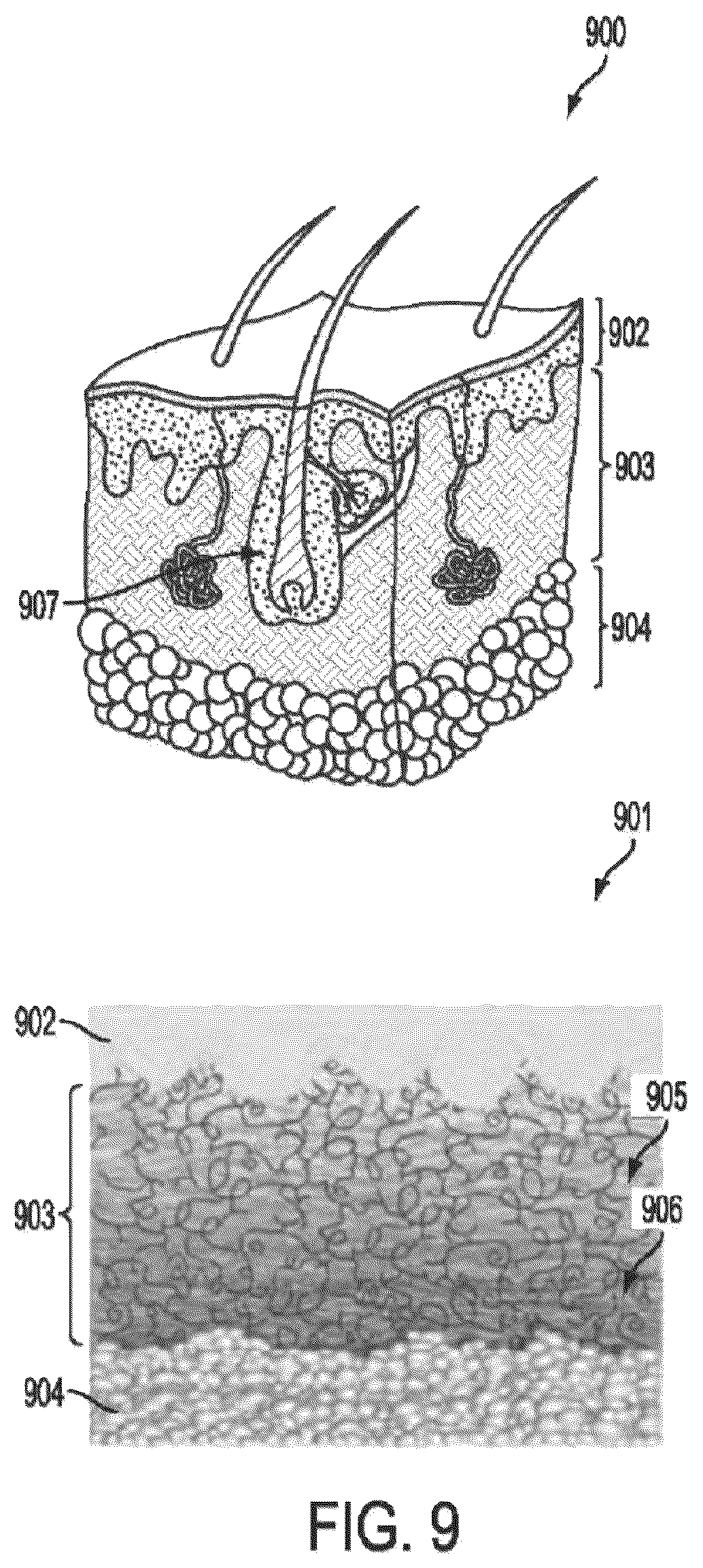 Patent US12599305 Figure 14 – 3D cameras or sensors inputting to multi-modal generative artificial intelligence models trained on images or videos