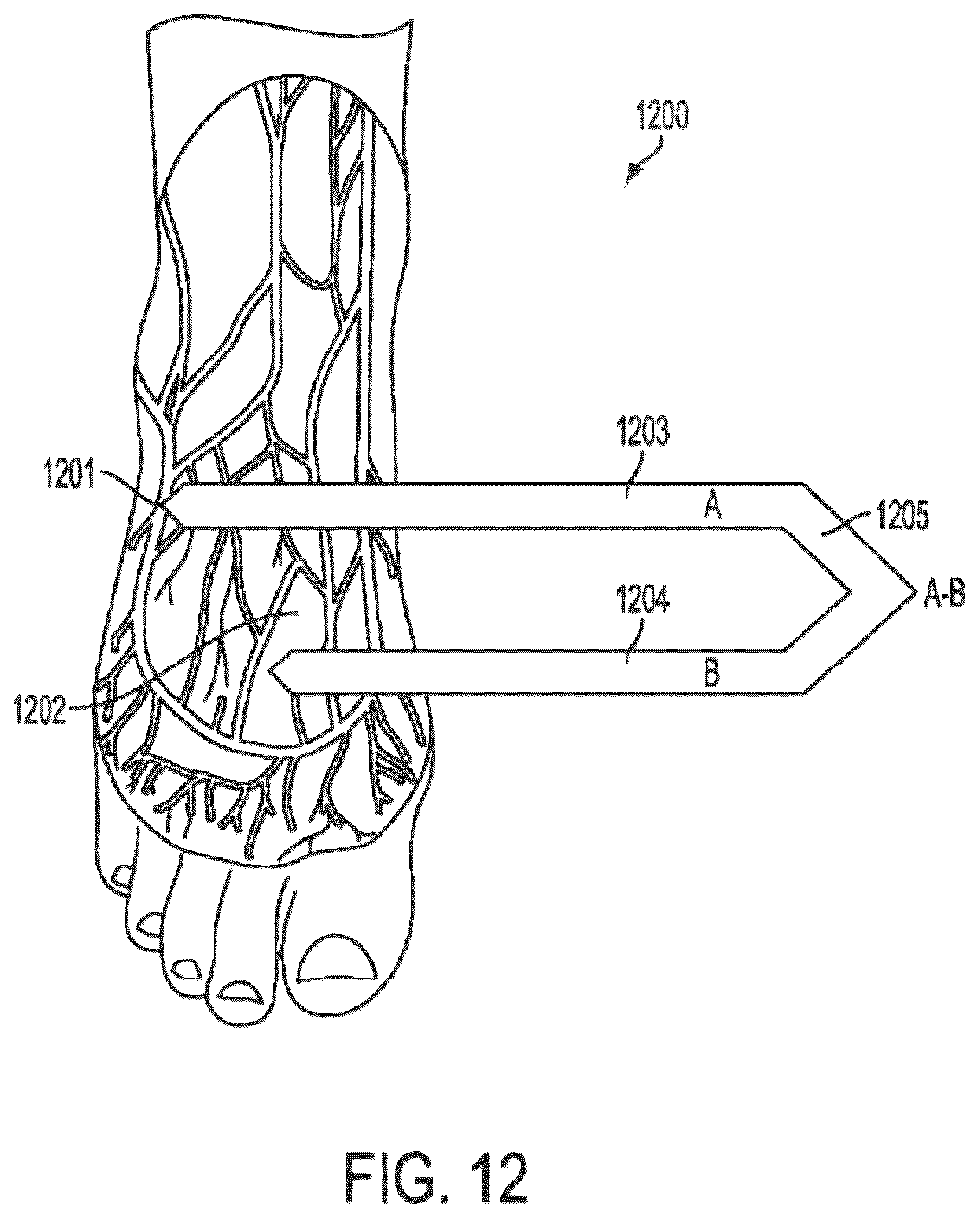 Patent US12599305 Figure 17 – 3D cameras or sensors inputting to multi-modal generative artificial intelligence models trained on images or videos