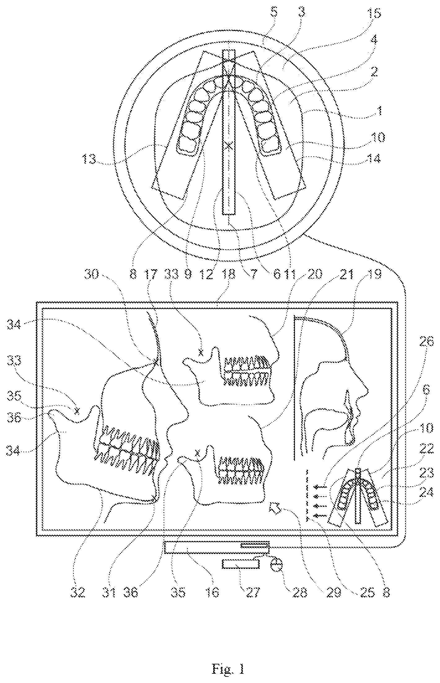 Patent US12599312 — Method for acquiring a dental object — Figure 1