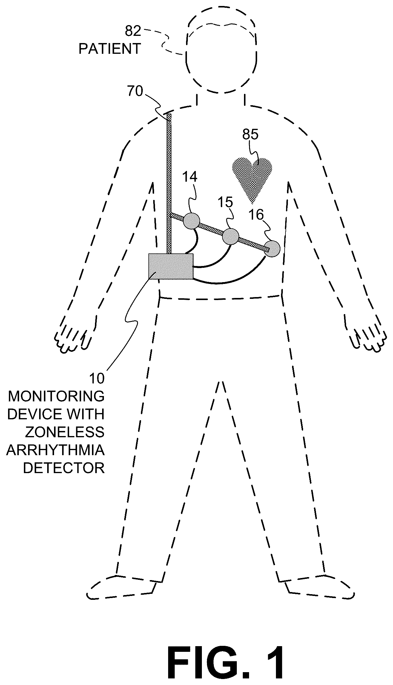 Patent US12599330 — Wearable medical device with zoneless arrhythmia detection — Figure 1