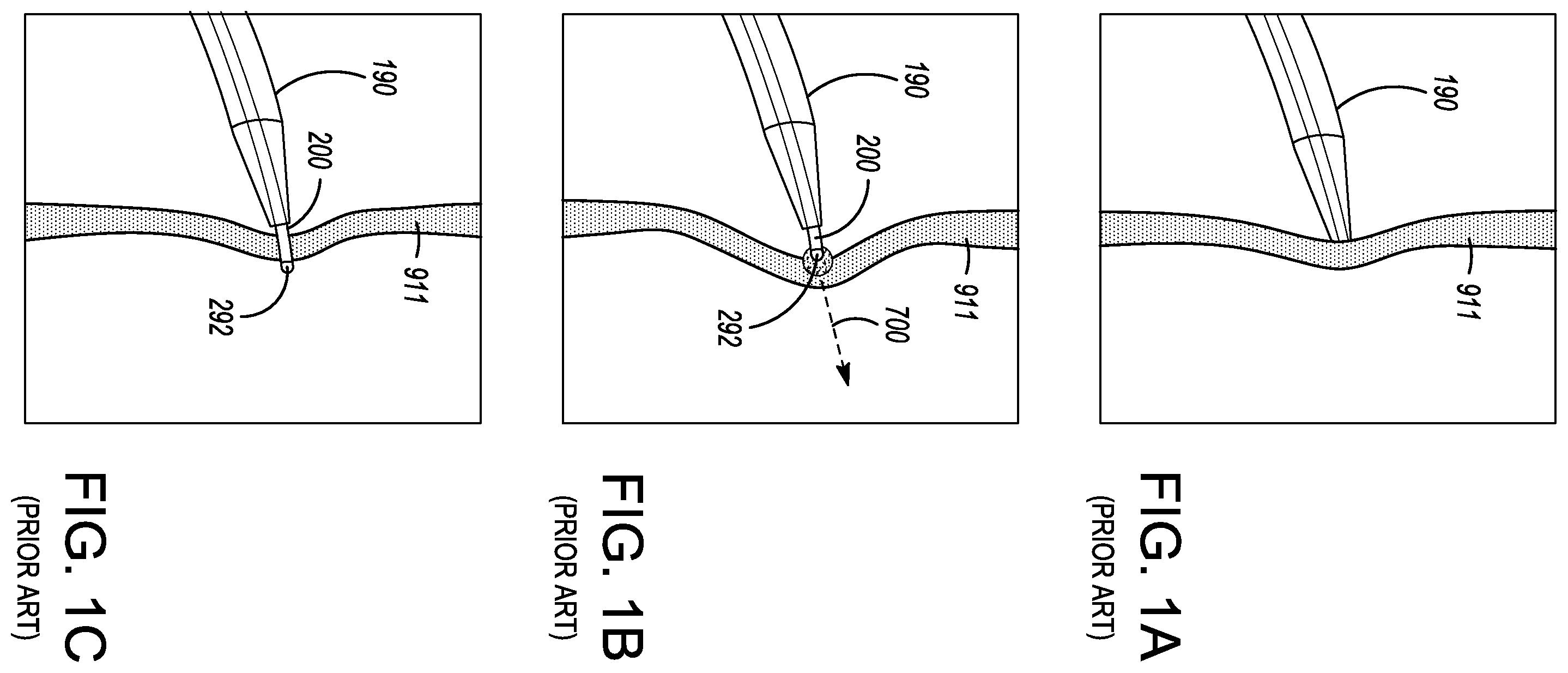 Patent US12599338 — Deflectable elongated guidewire assembly — Figure 1