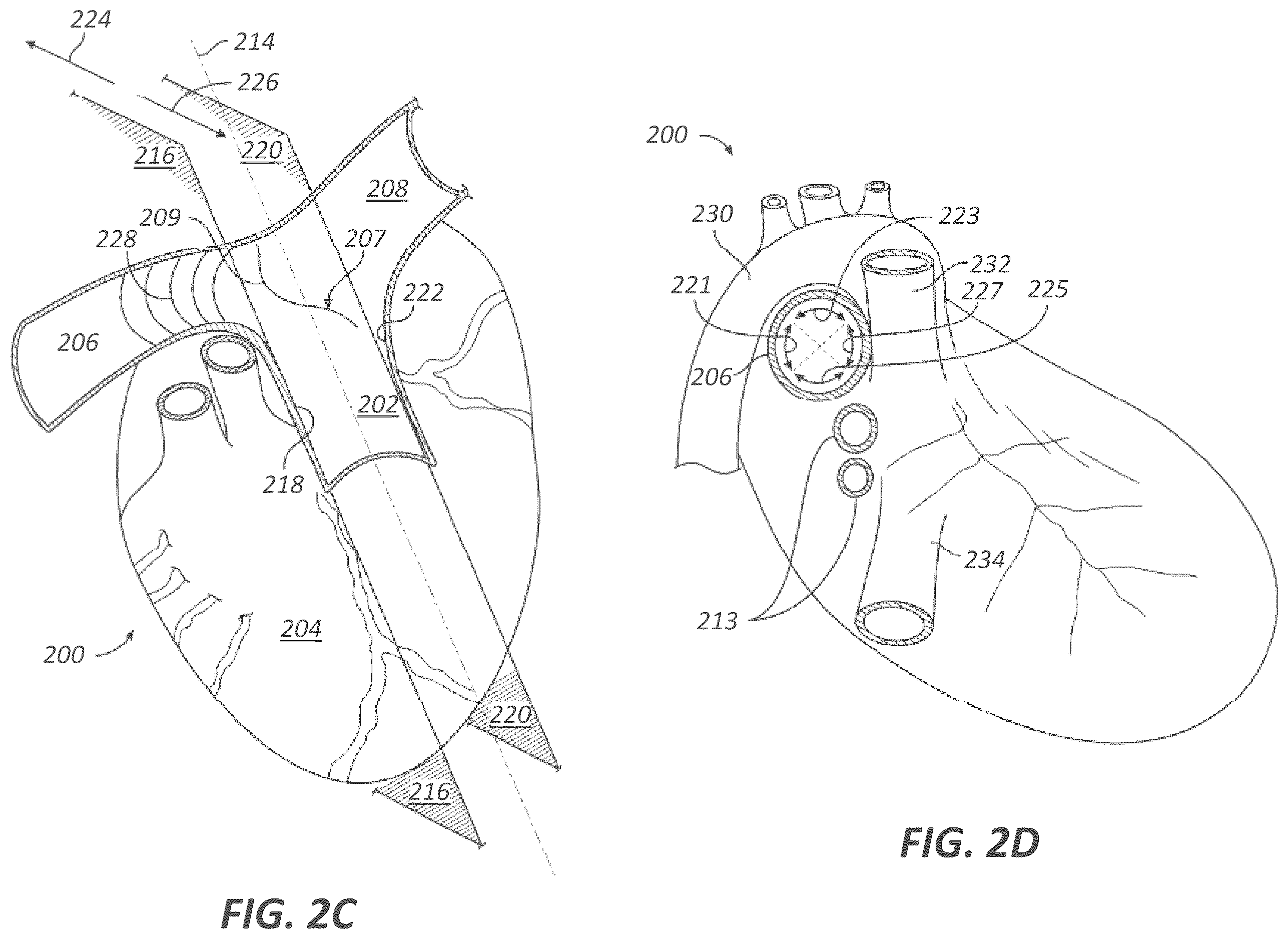 Patent US12599339 Figure 3 – Systems and methods for affecting cardiac contractility and/or relaxation
