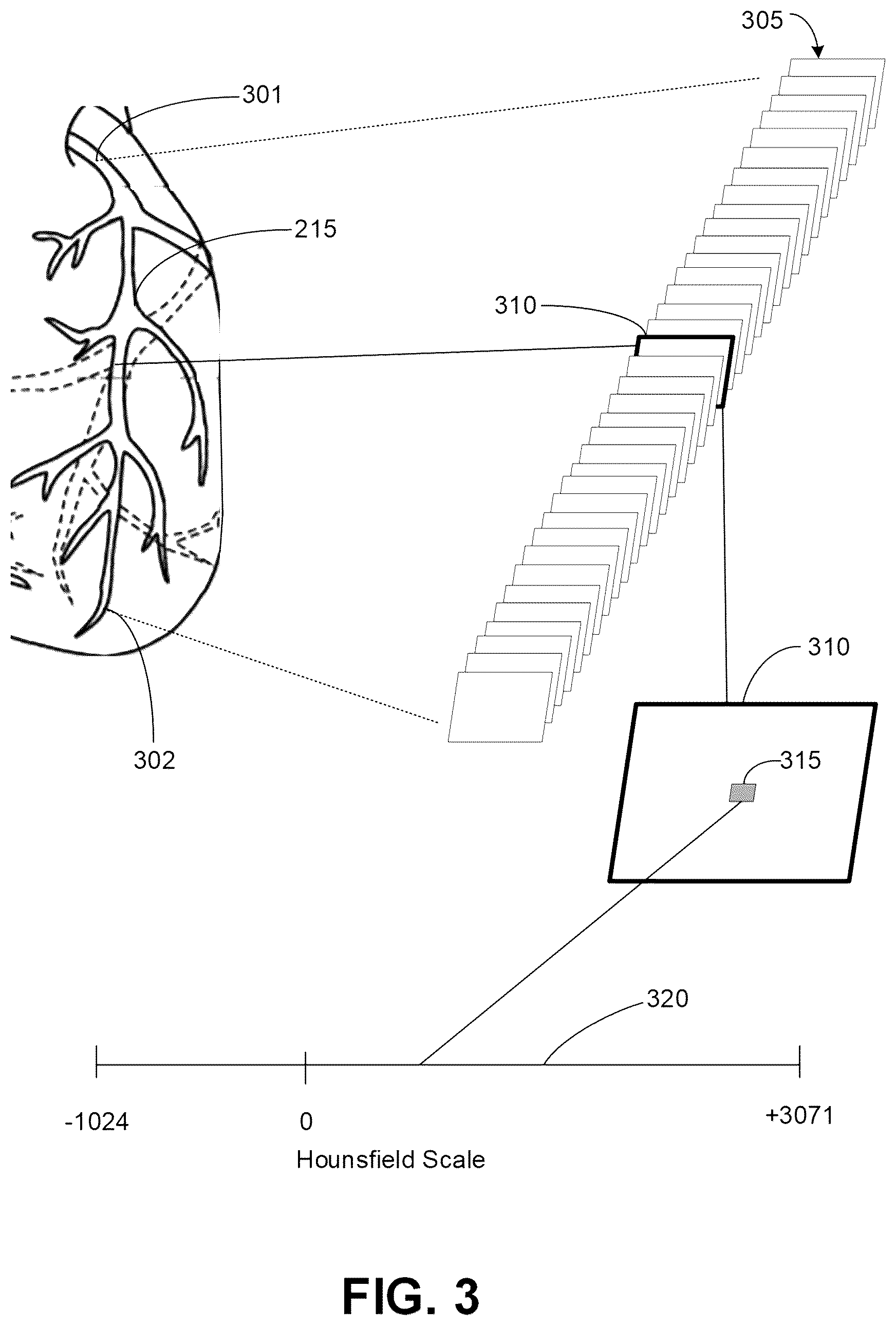 Patent US12599352 Figure 3 – Systems, devices, and methods for non-invasive image-based plaque analysis and risk determination