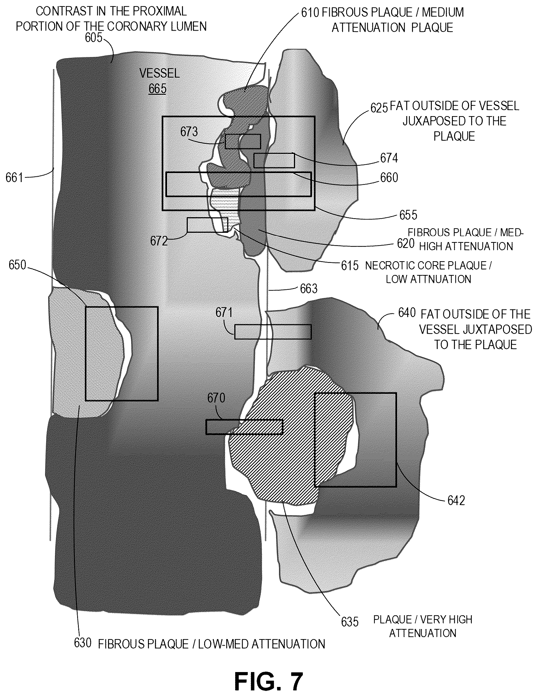 Patent US12599352 Figure 9 – Systems, devices, and methods for non-invasive image-based plaque analysis and risk determination