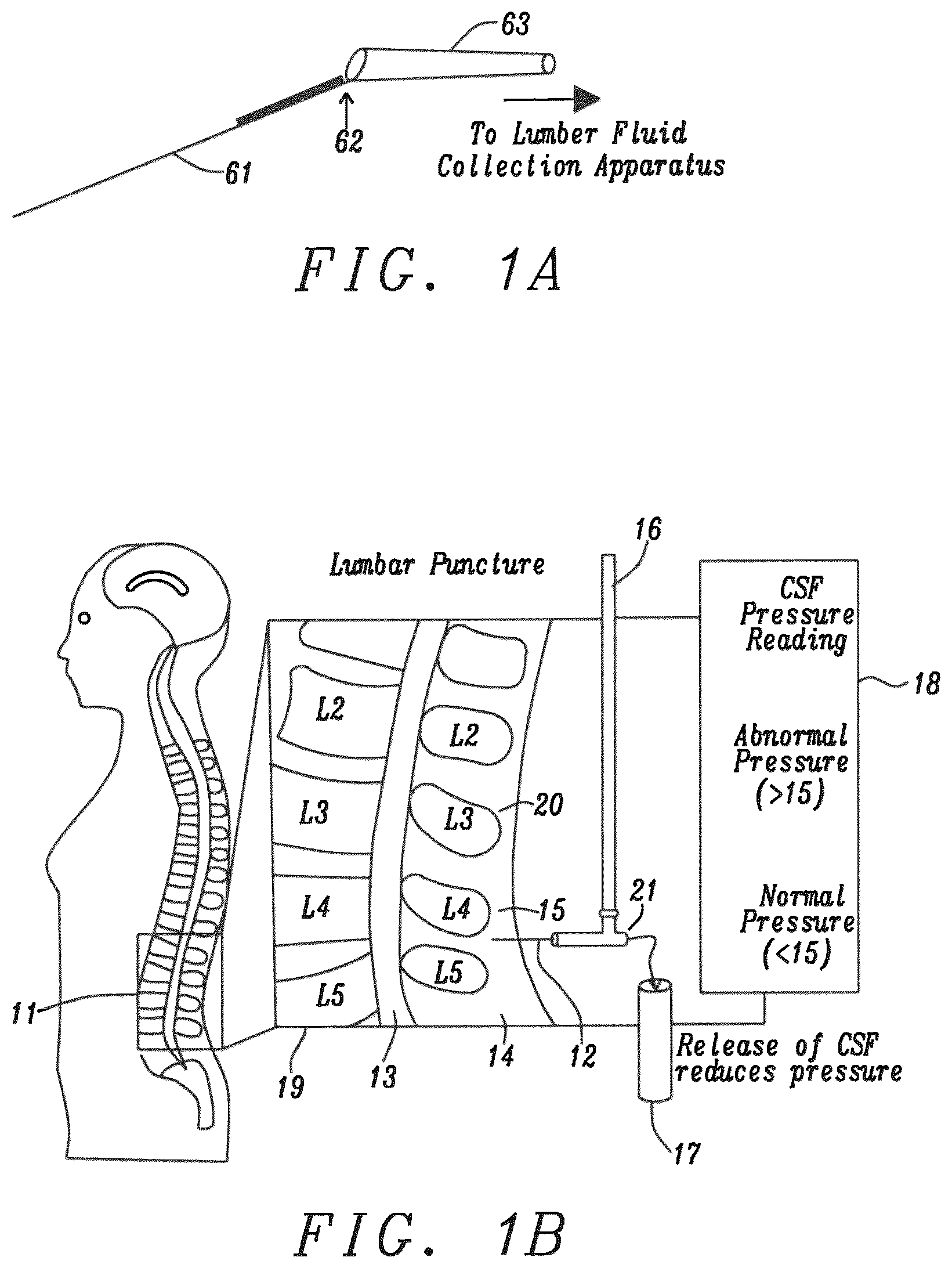 Patent US12599372 — Lumbar puncture locator device — Figure 1